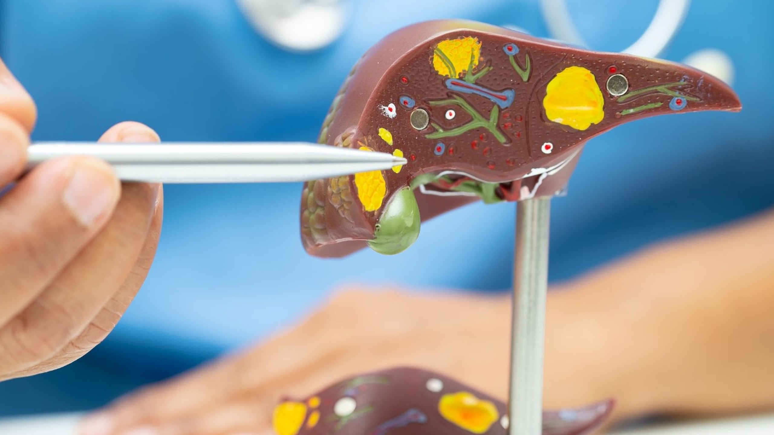 Phân độ bệnh não gan: Định nghĩa, triệu chứng và phương pháp điều trị