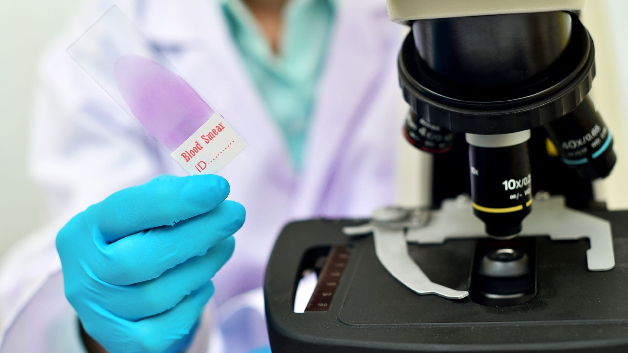 Soi ký sinh trùng sốt rét: Quy trình và những lưu ý quan trọng