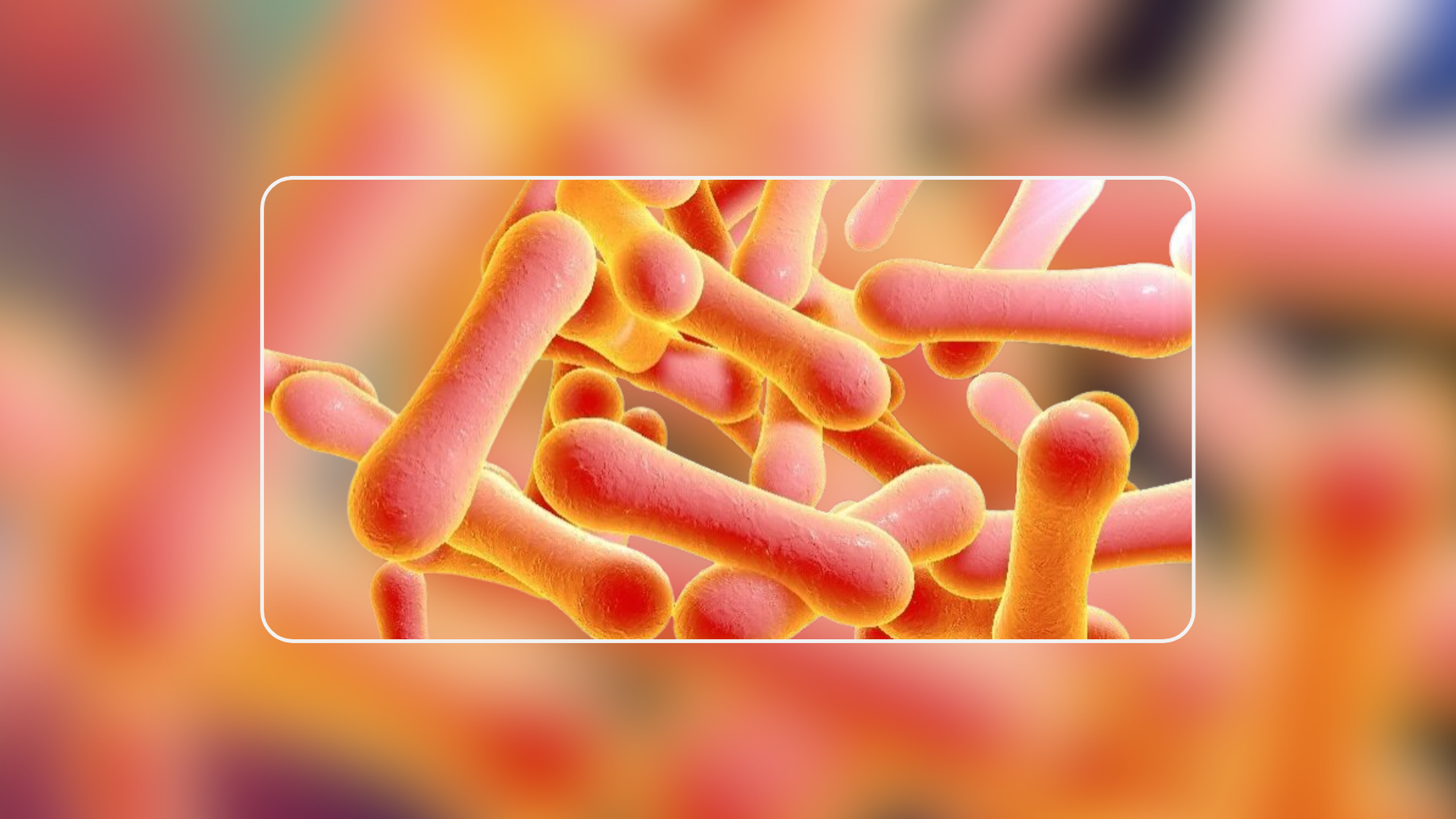 Tổng hợp các hình ảnh bệnh bạch hầu để nhận biết bệnh sớm 0