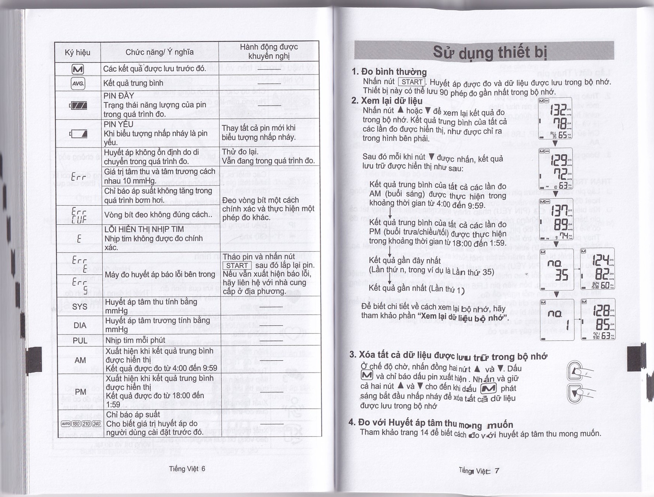 Máy đo huyết áp bắp tay AND UA-1020 Afib hỗ trợ đo huyết áp, cảnh báo đột quỵ
