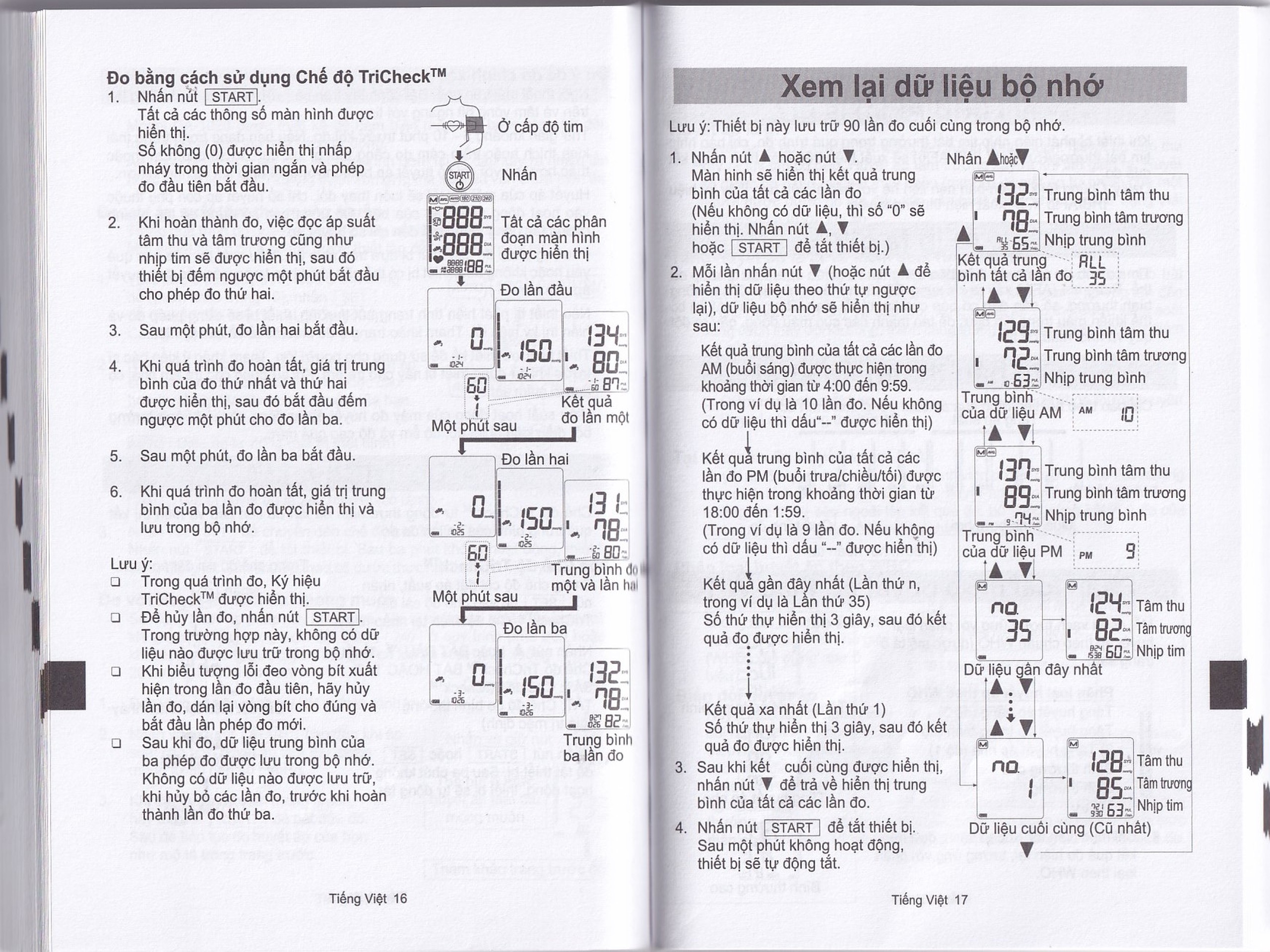 Máy đo huyết áp bắp tay AND UA-1020 Afib hỗ trợ đo huyết áp, cảnh báo đột quỵ