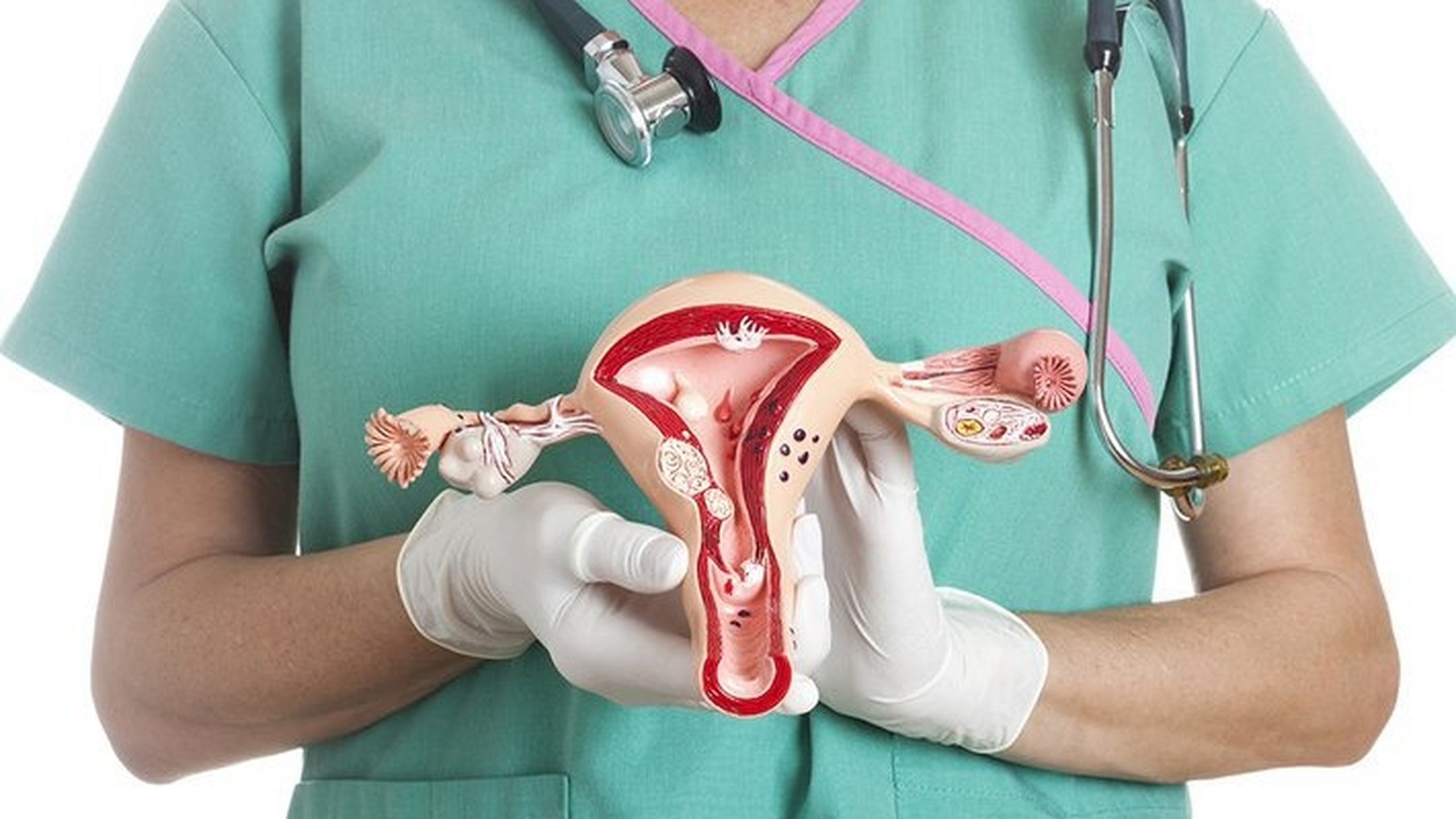 Ung thư cổ tử cung giai đoạn 3: Triệu chứng và phương pháp điều trị