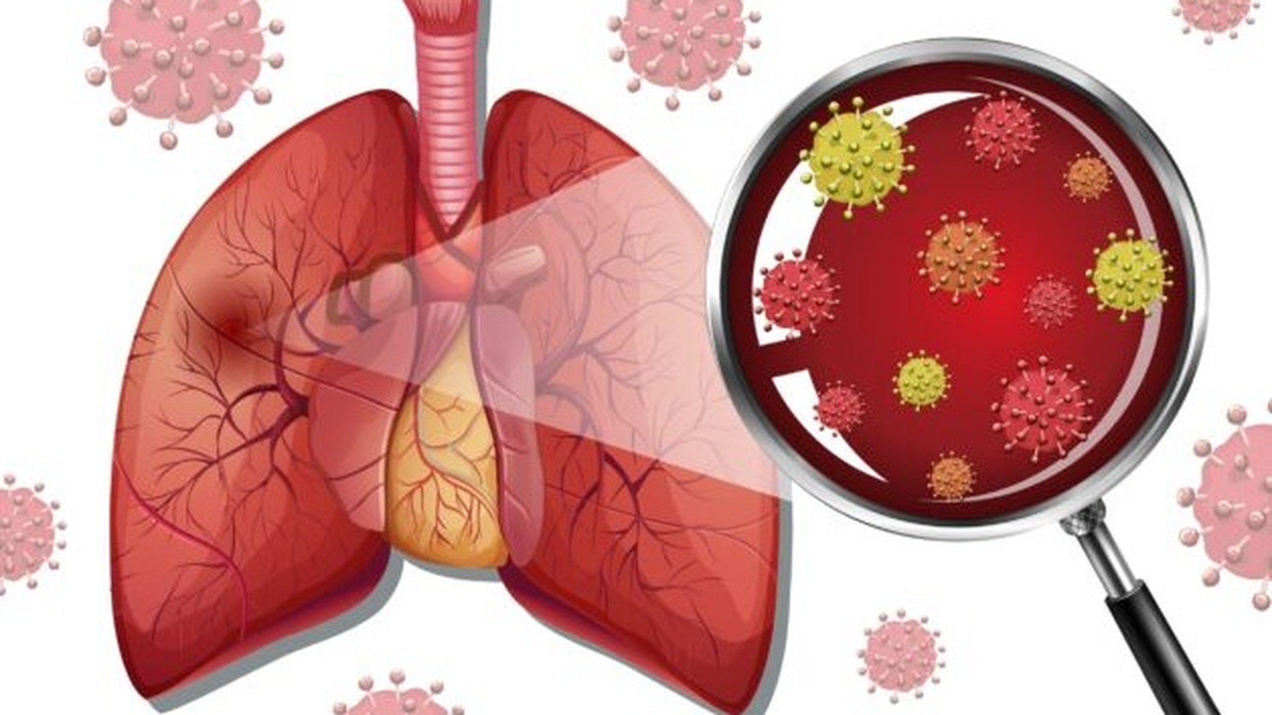 Viêm phổi tăng cảm là gì? Triệu chứng nhận biết và cách điều trị bệnh hiệu quả