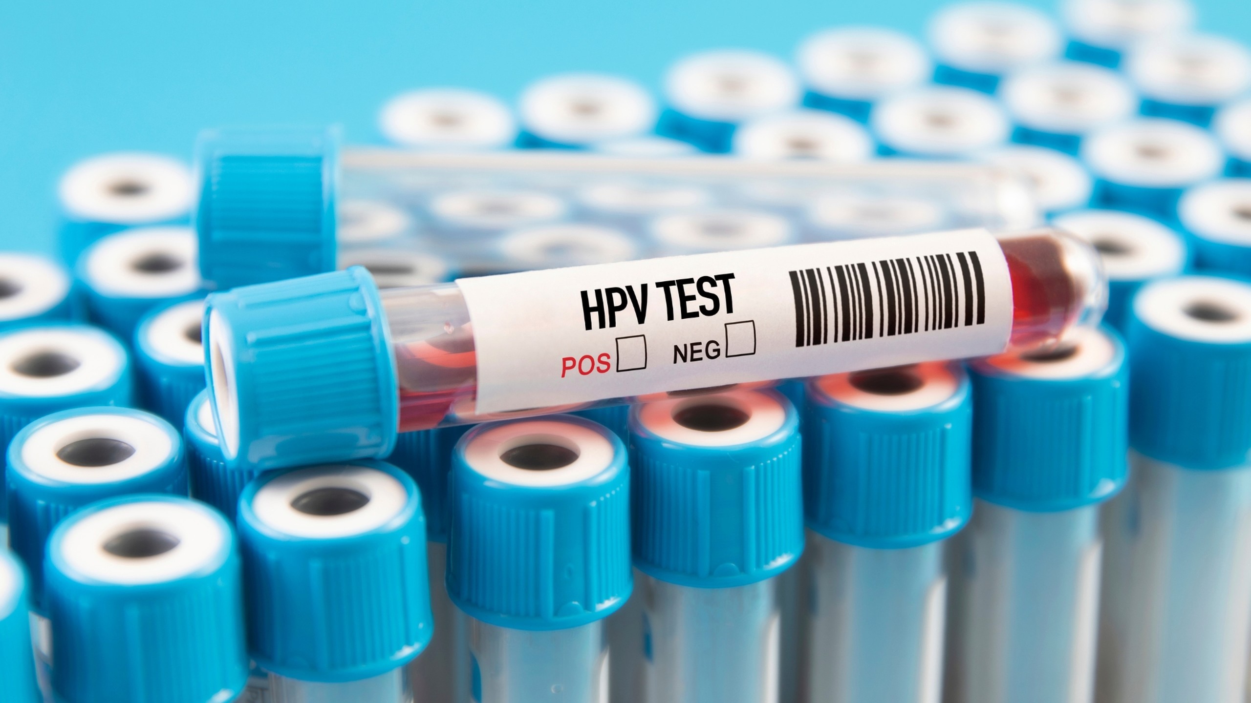 Xét nghiệm HPV là gì? Quy trình, chi phí và cách đọc kết quả 1