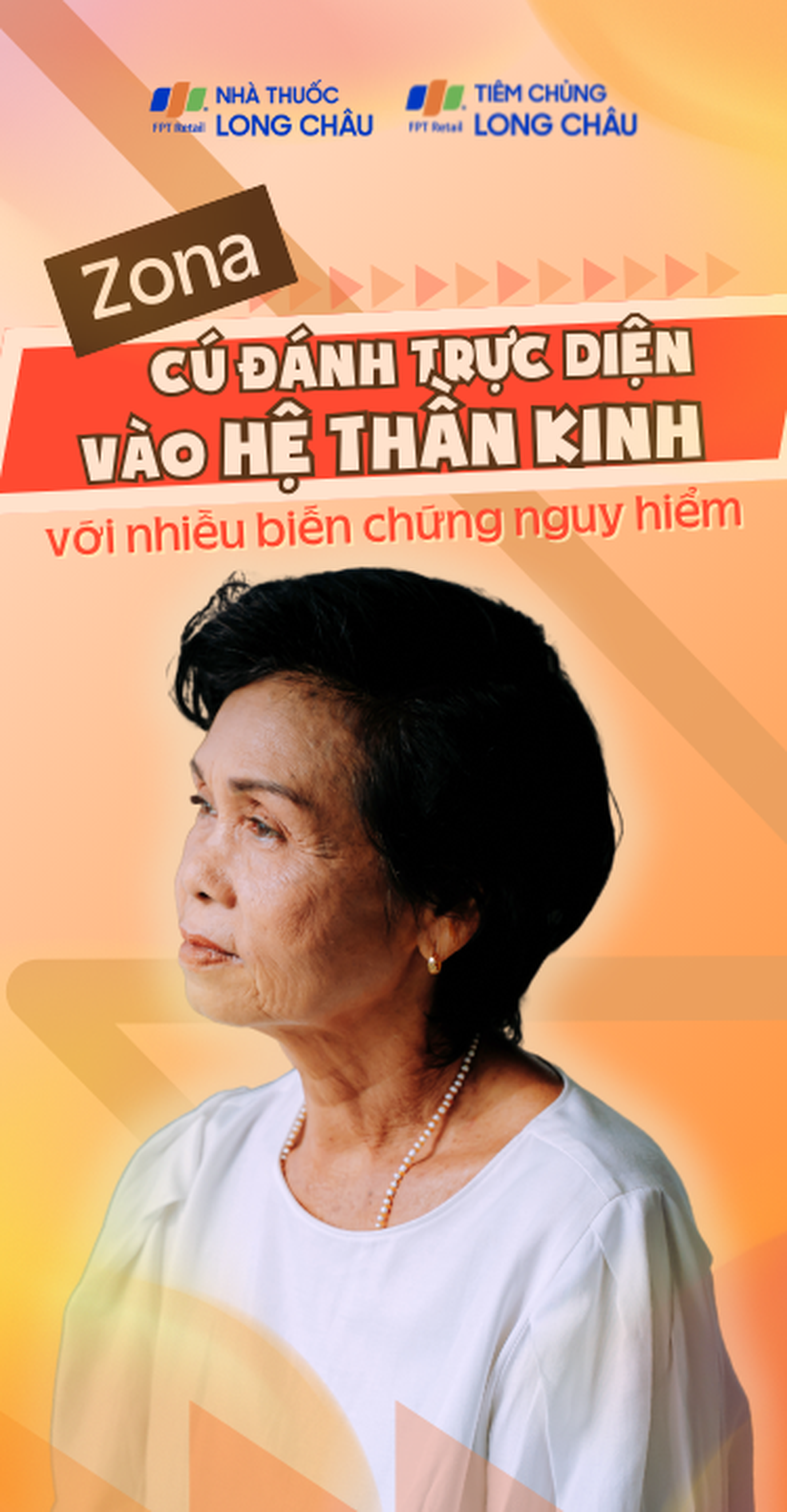 Zona - Cú đánh trực diện vào hệ thần kinh với nhiều biến chứng nguy hiểm Mobile