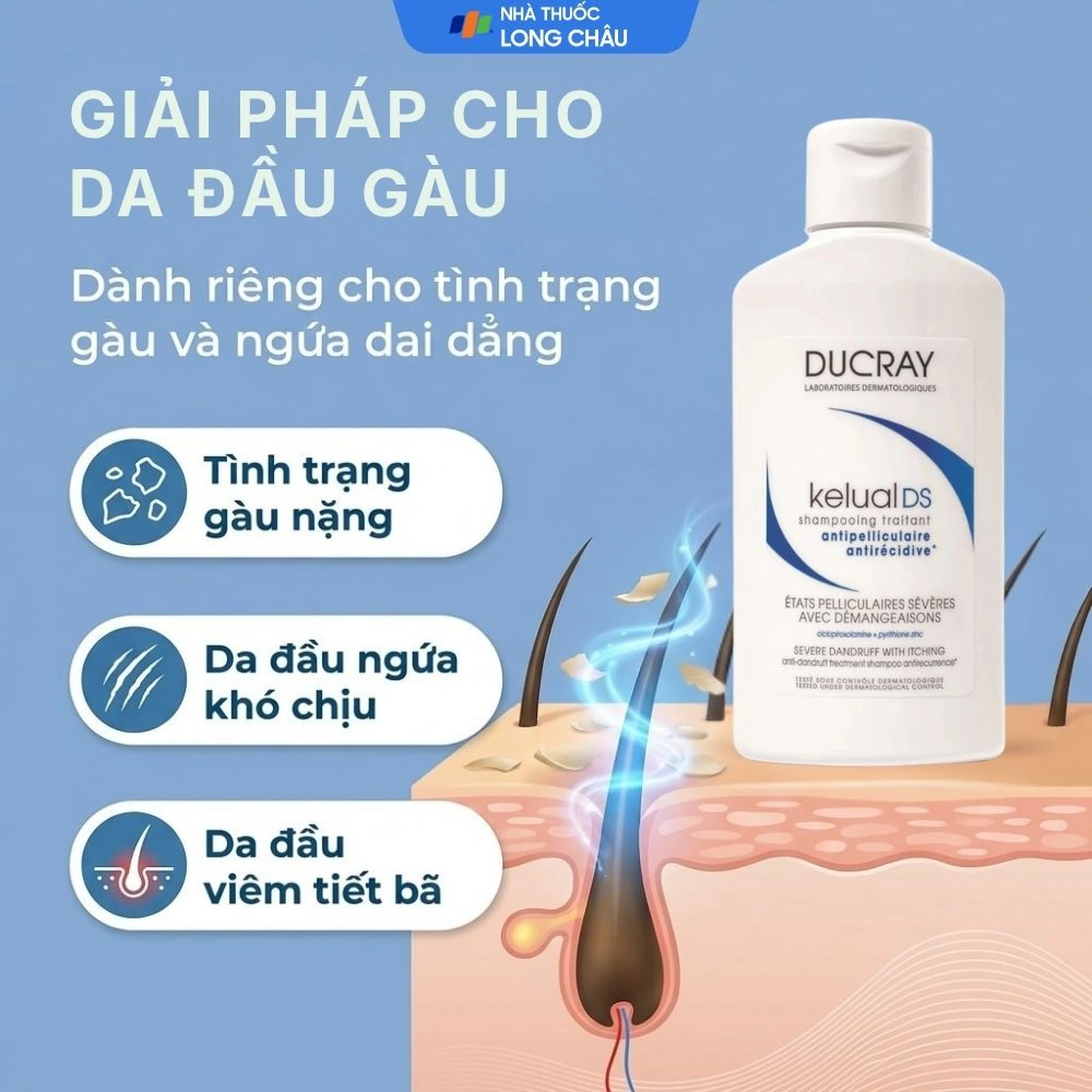 Dầu gội Ducray Kelual DS Shampoo làm sạch gàu, dịu da đầu và bớt ngứa (100ml) 4