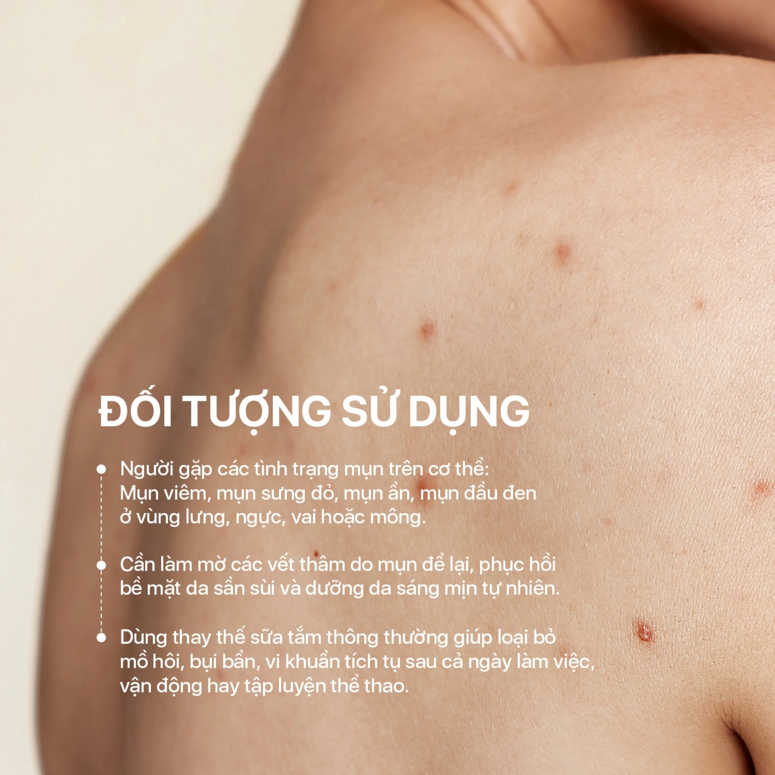 Xà phòng tắm ngừa mụn La Beauty Acnes Body Bar chứa nghệ và tinh chất dầu tràm 75g 4