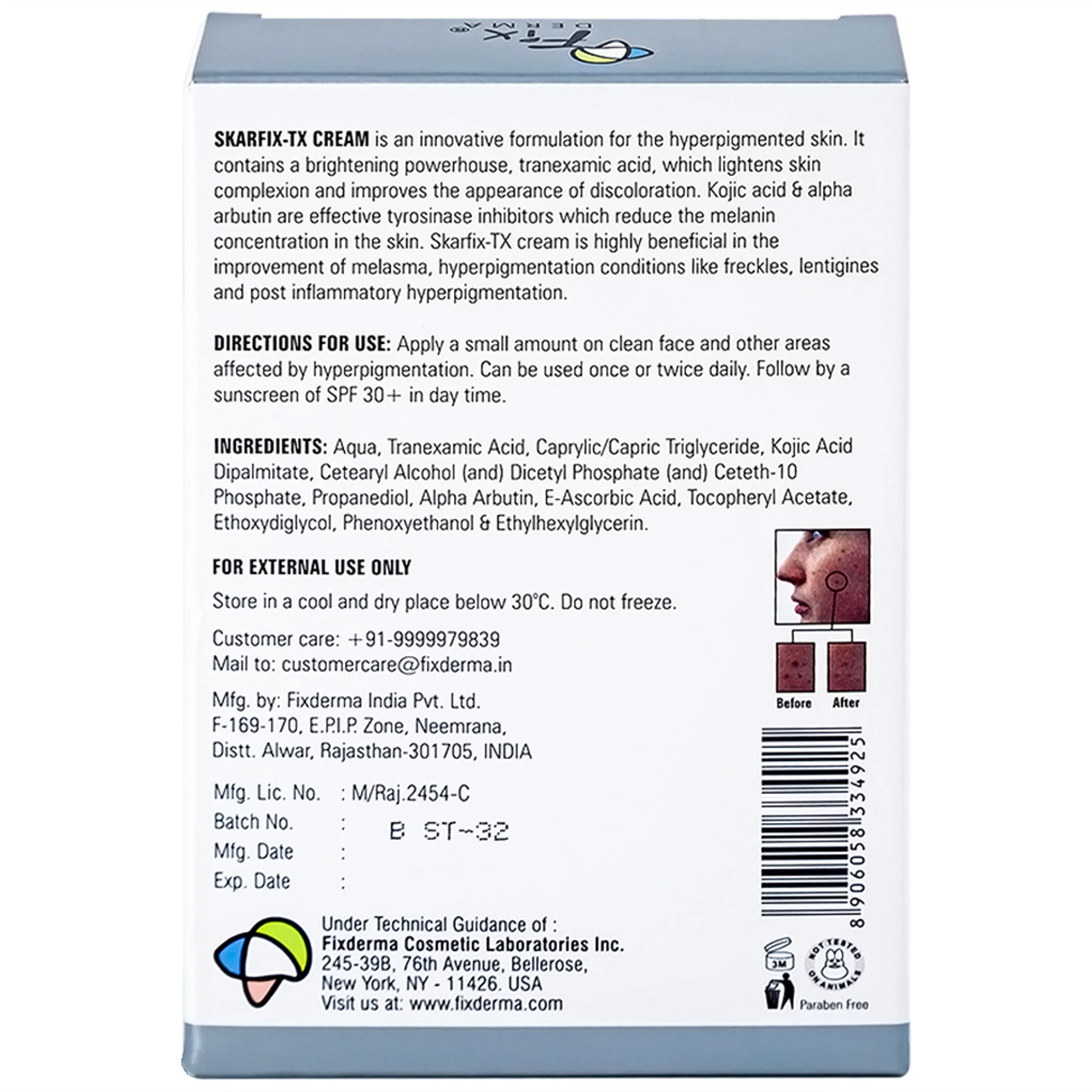 Kem bôi ngừa nám, tàn nhang Fixderma Skarfix TX cream 15g