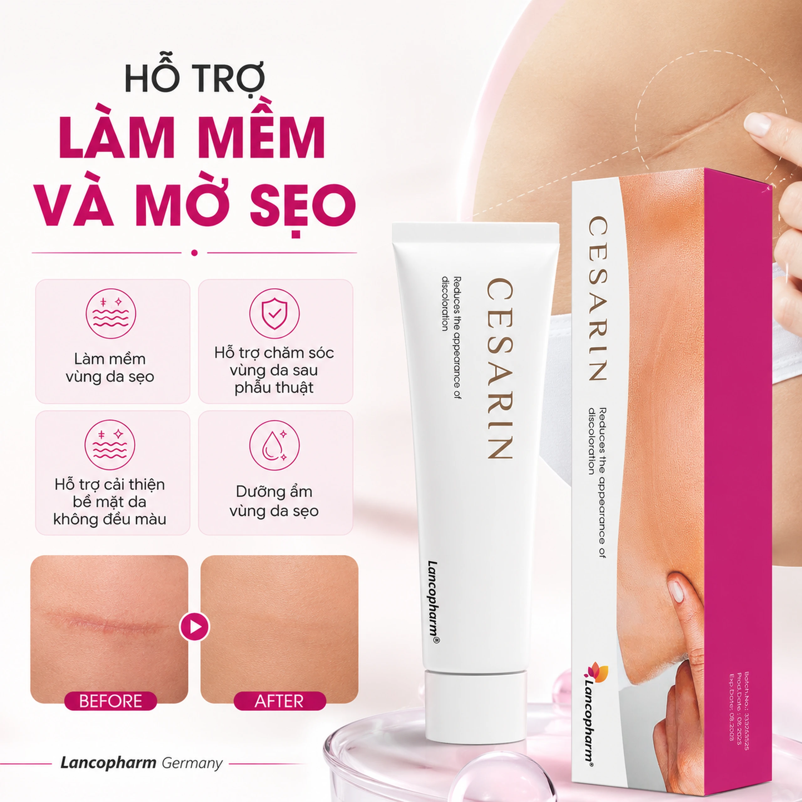 Kem bôi mờ sẹo sau phẫu thuật Cesarin Ointment Lancopharm 30g 3