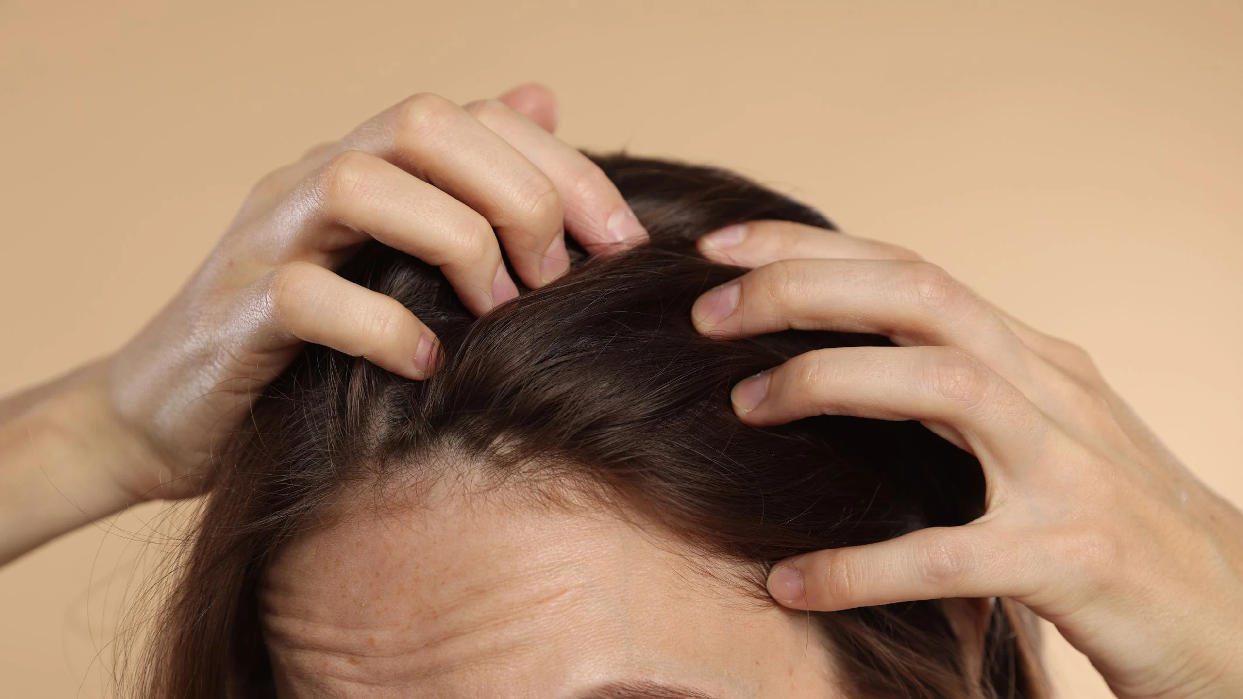 3 loại thực phẩm ăn hàng ngày khiến tóc càng thêm rụng