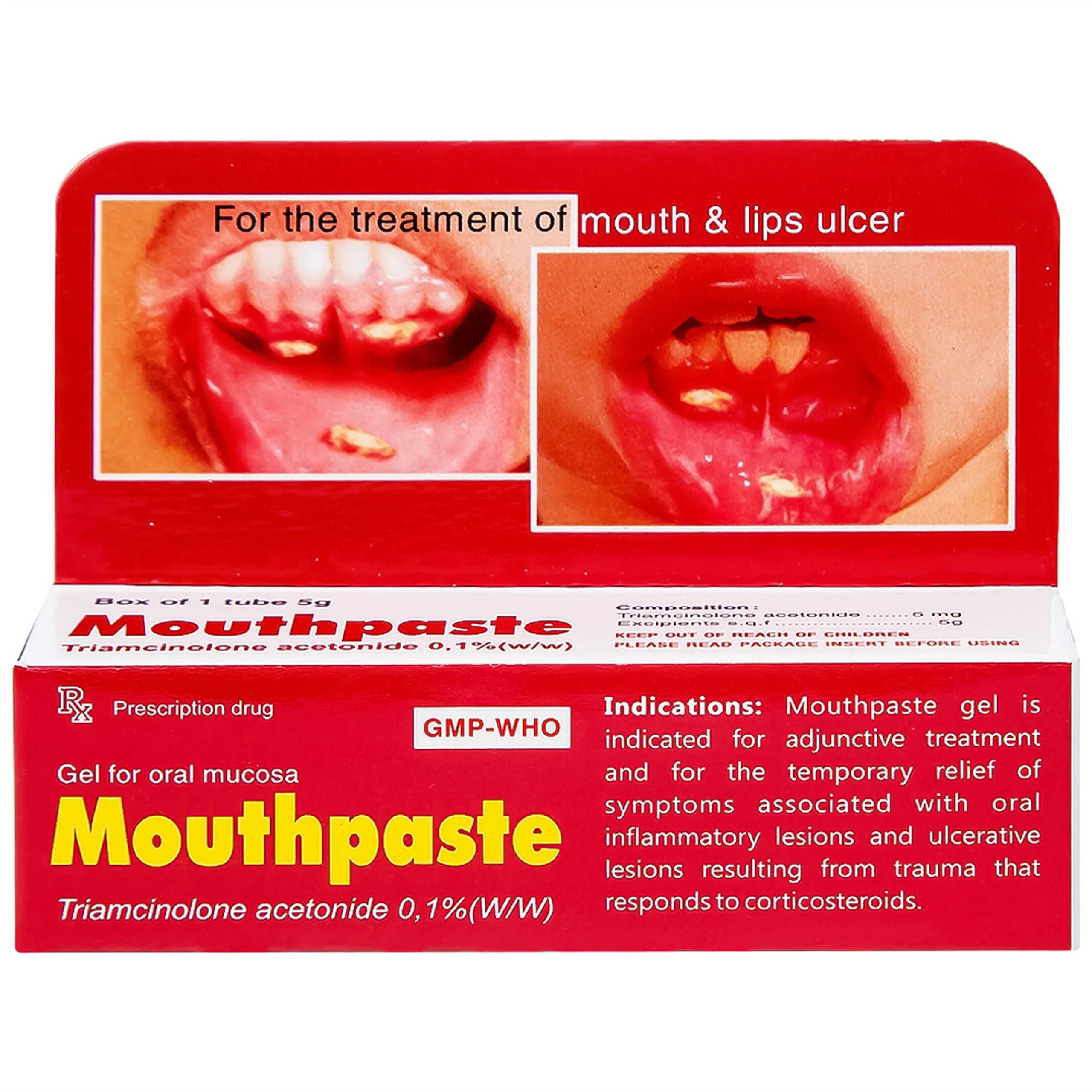 Gel bôi niêm mạc miệng Mouthpaste Medipharco giảm viêm, tổn thương (5g)