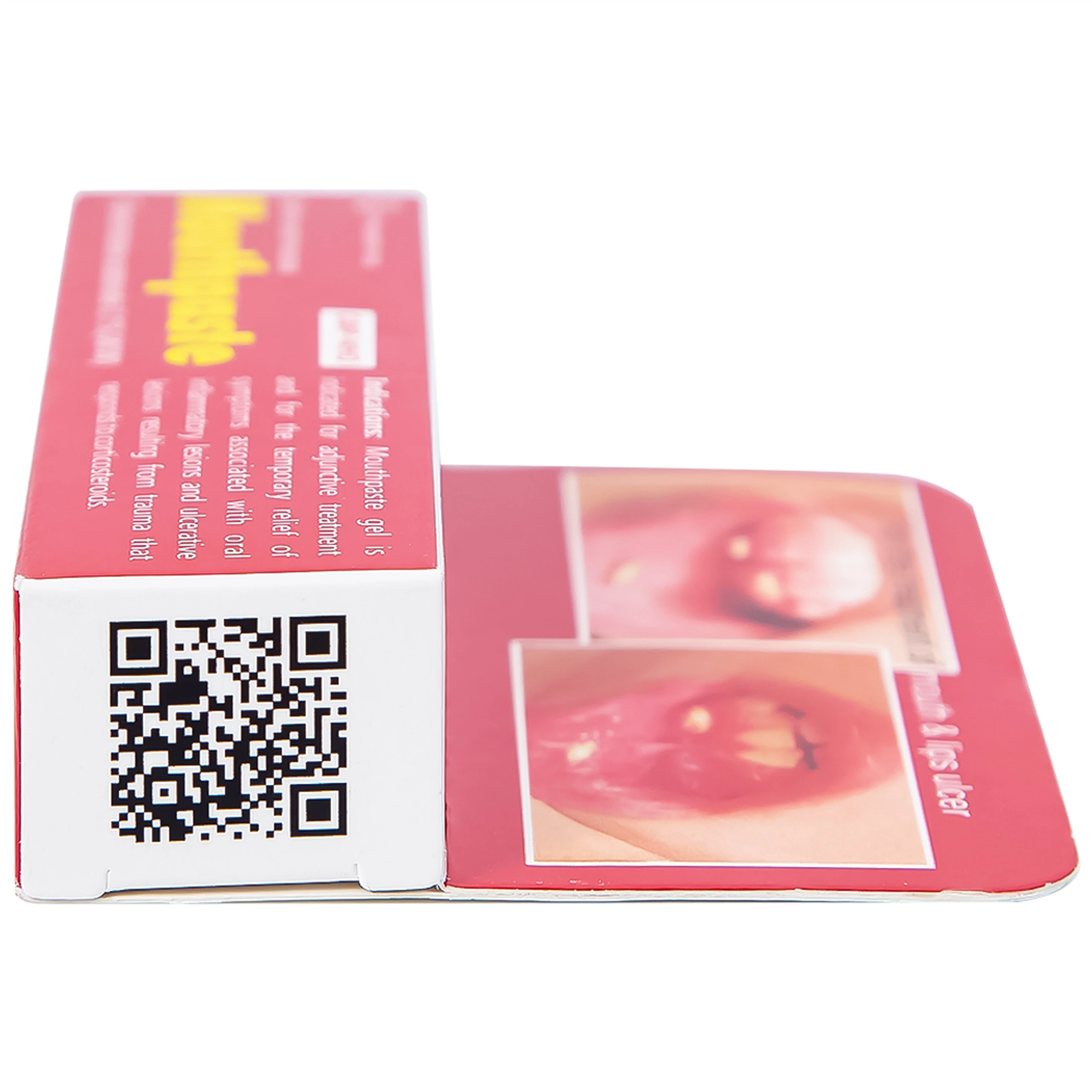 Gel bôi niêm mạc miệng Mouthpaste Medipharco giảm viêm, tổn thương (5g)