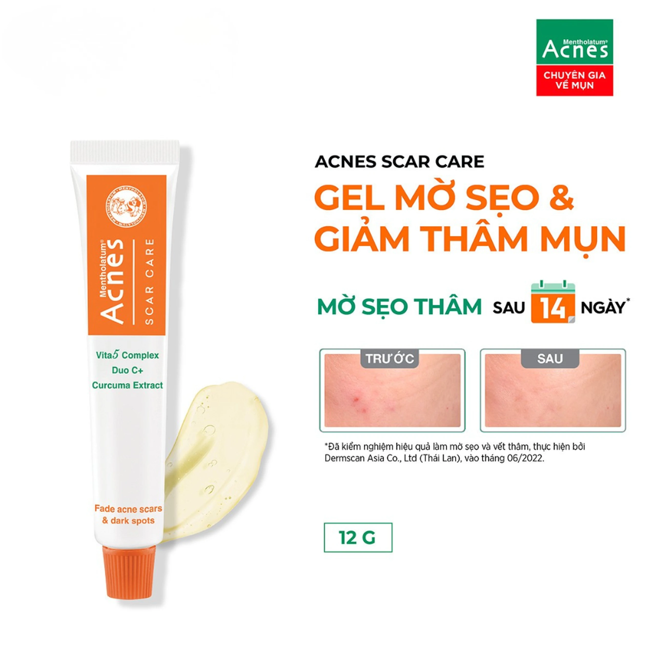Gel mờ sẹo và giảm thâm mụn Acnes Scar Care Rohto (12g) 2