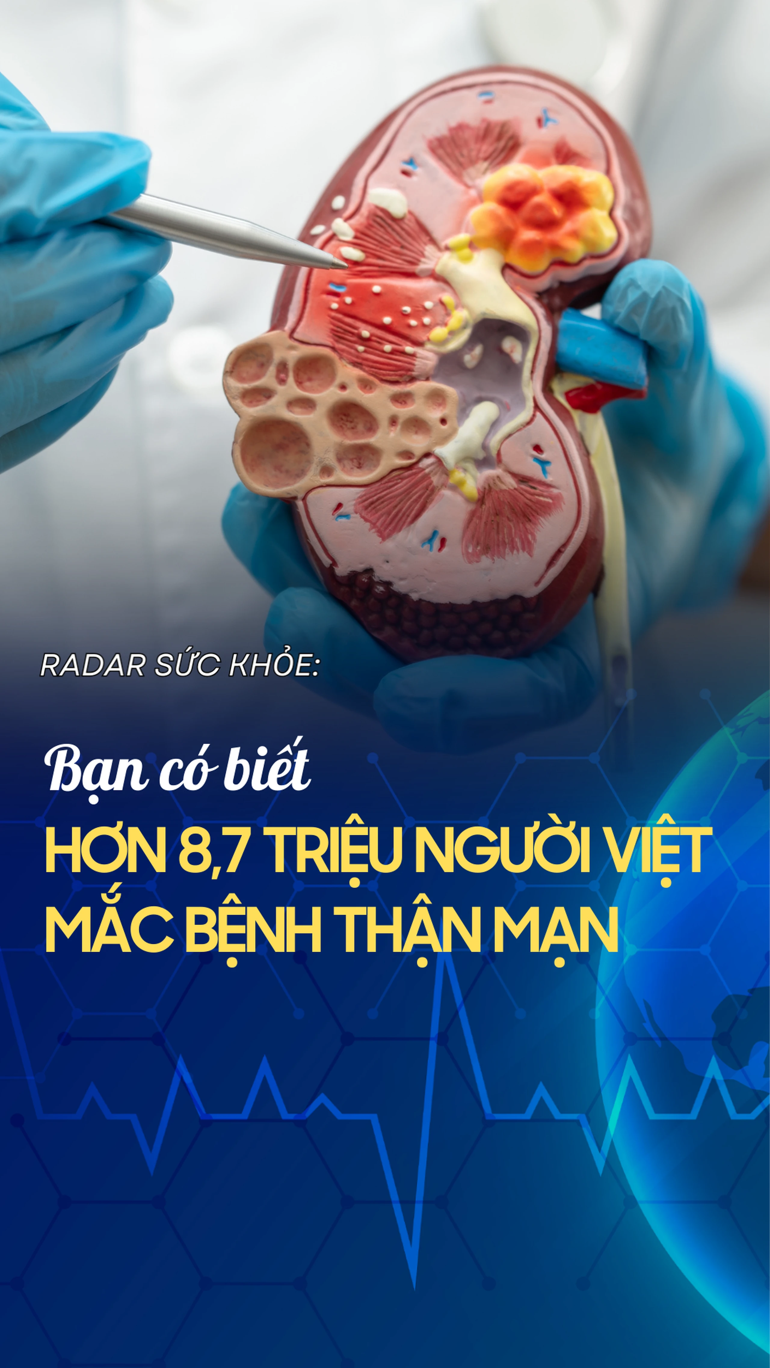 Bạn có biết: Hơn 8,7 triệu người Việt mắc bệnh thận mạn