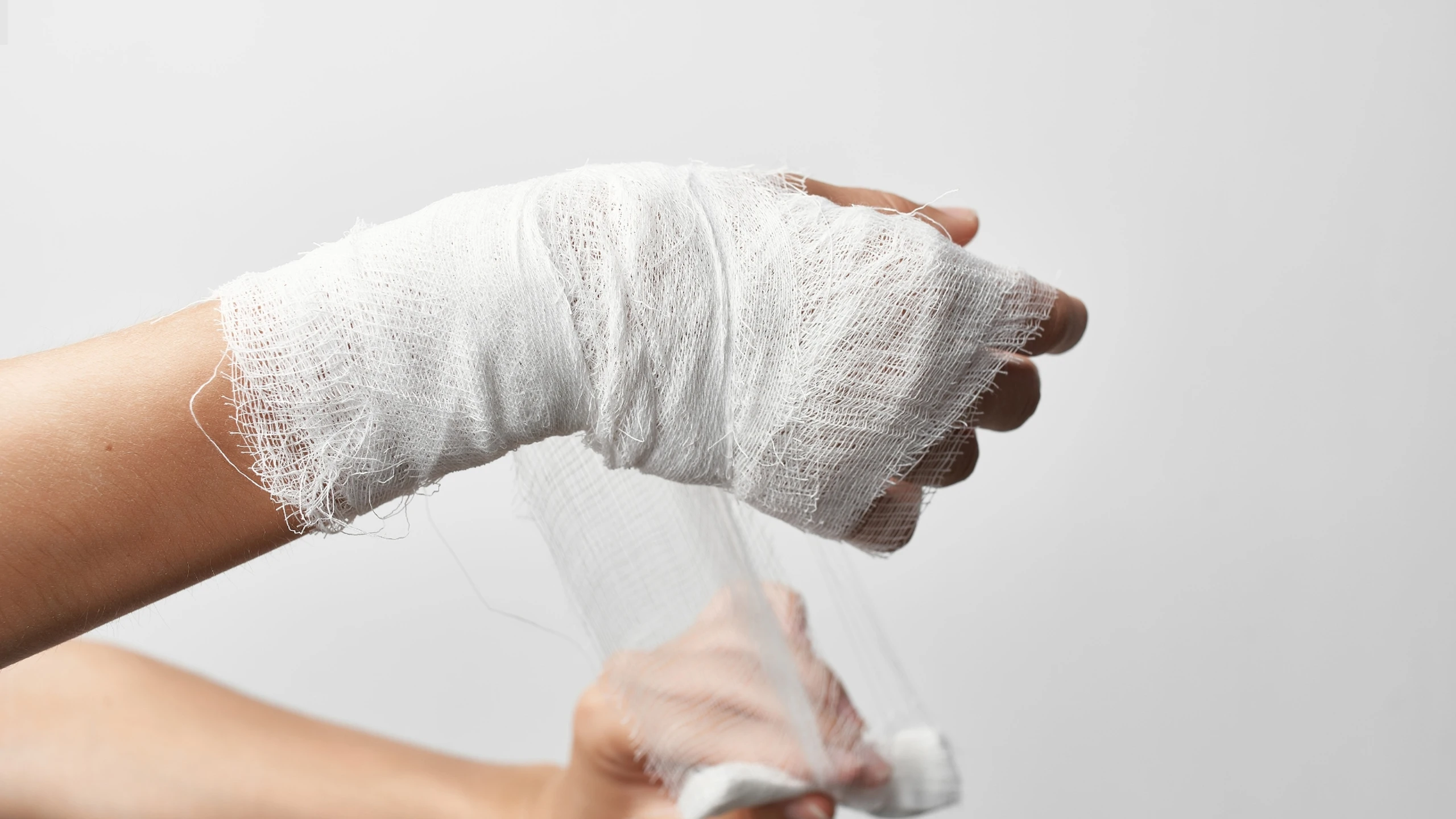 Bị rạn xương bao lâu thì khỏi? Quá trình lành xương sau khi xương bị rạn 0