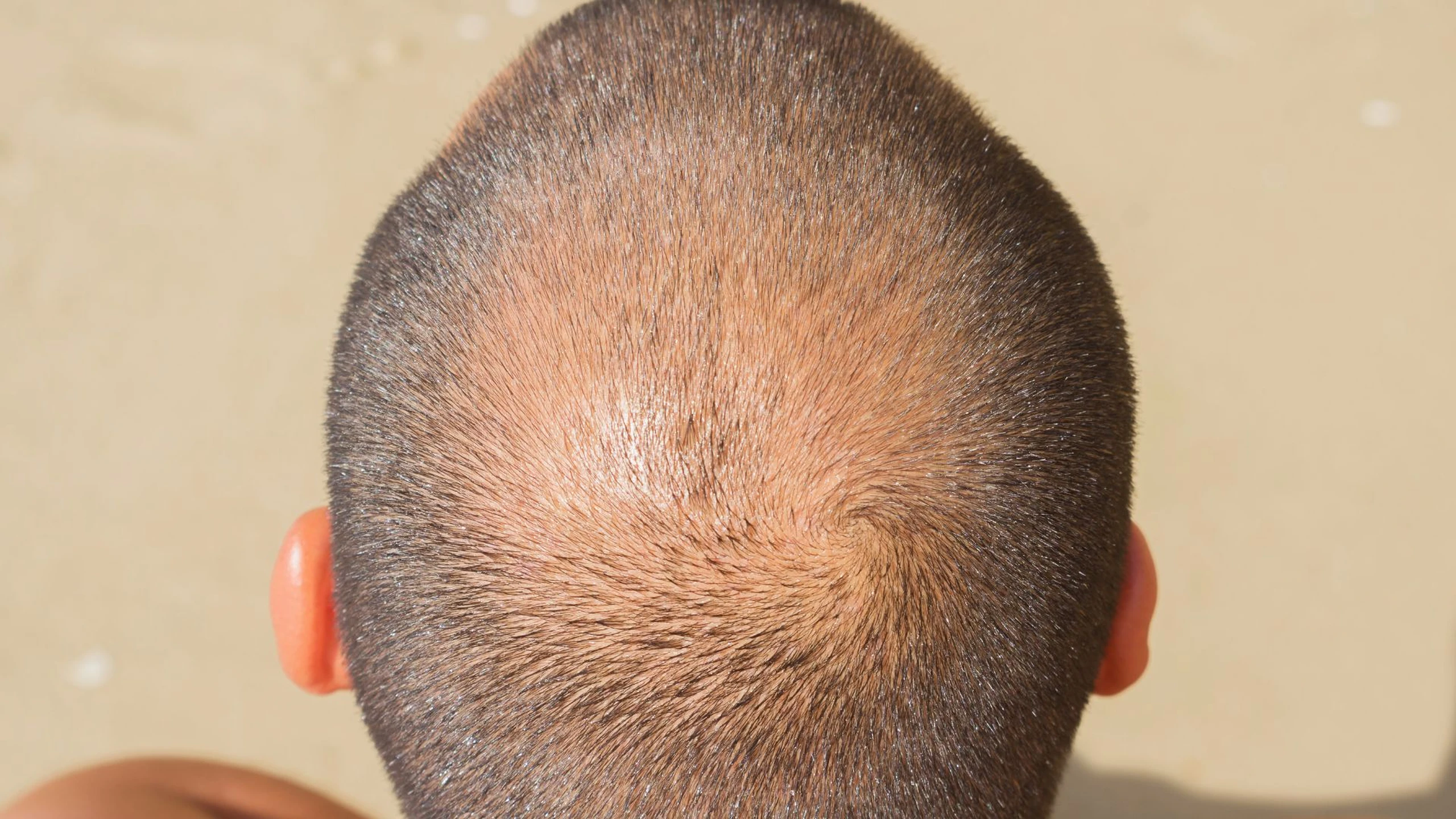Các loại khối u trên đầu thường gặp là gì? Dấu hiệu nhận biết khối u nguy hiểm