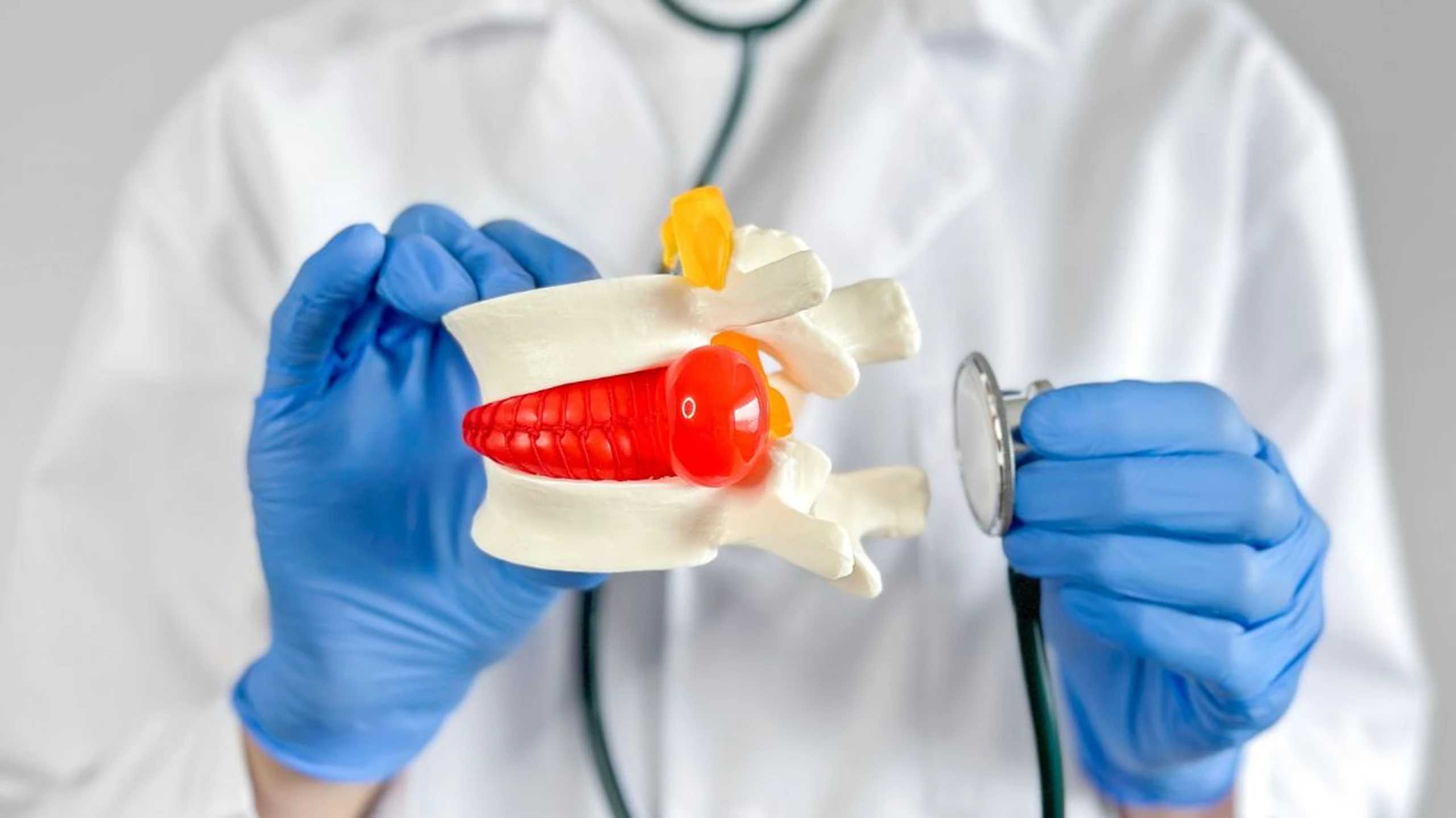 Cách chữa thoát vị đĩa đệm L4 L5: Điều trị theo mức độ bệnh
