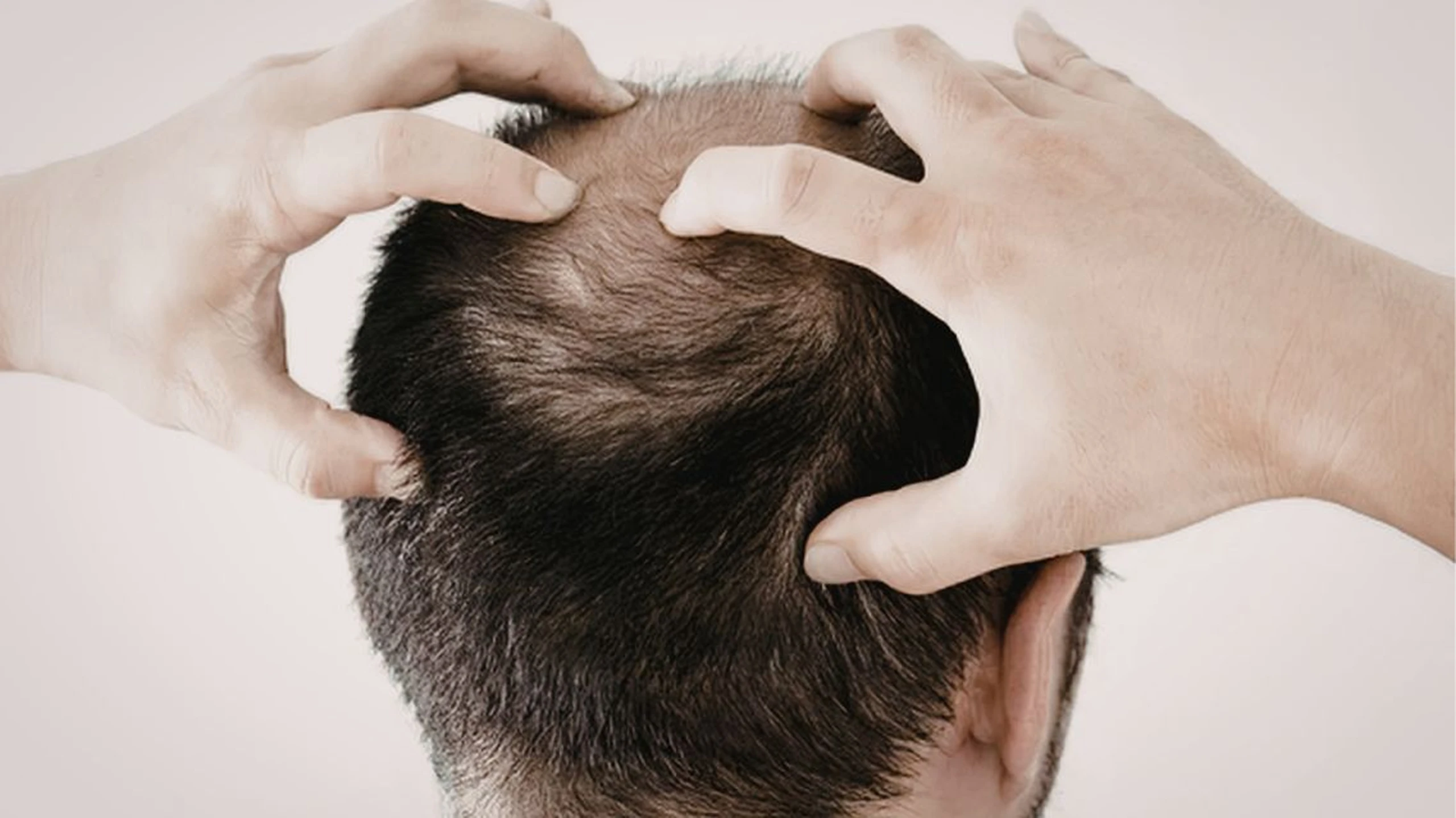 Tổng hợp các cách trị hói đầu phổ biến: Giải pháp nào thực sự hiệu quả?