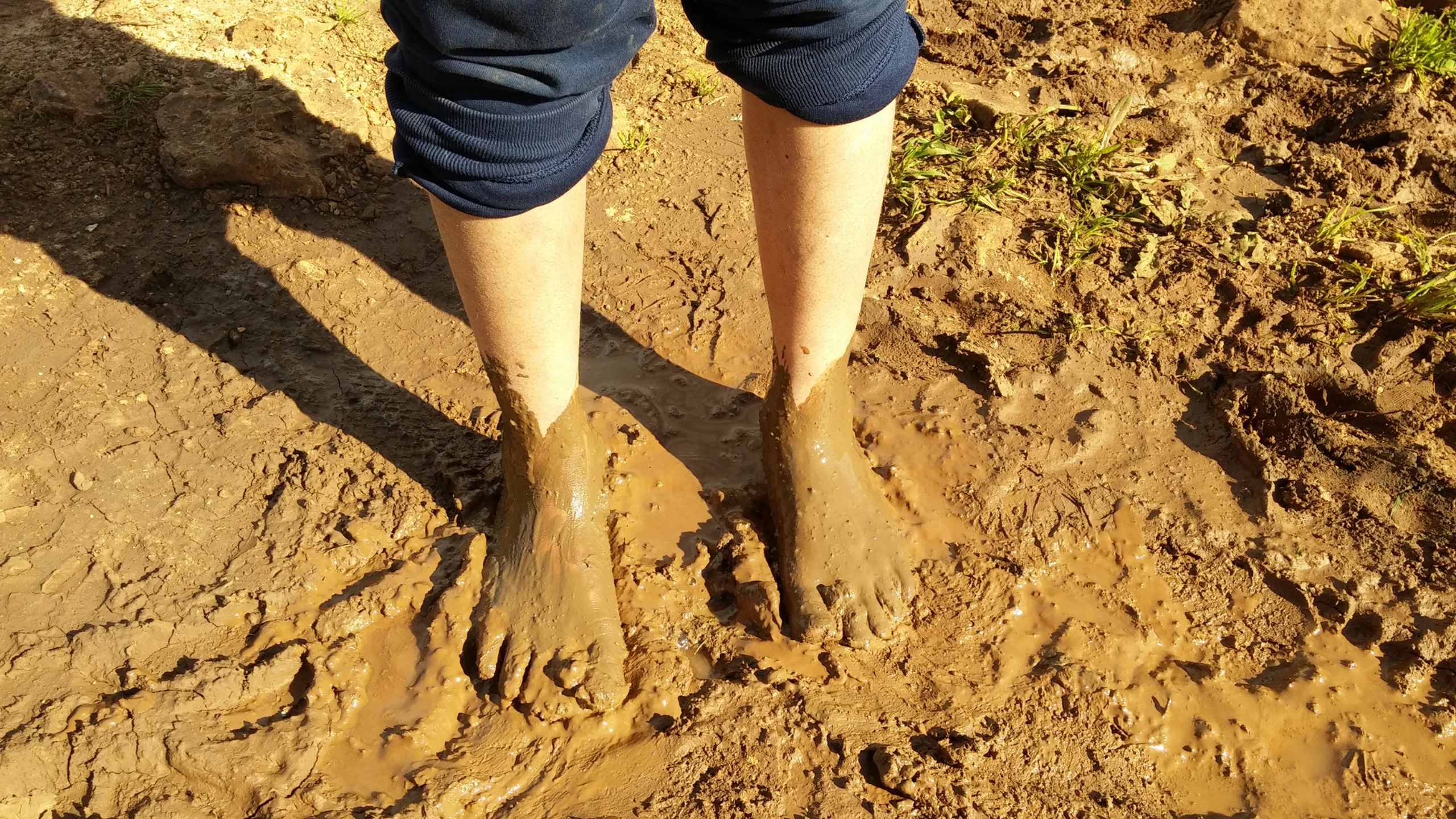 Cảnh báo bệnh sốt đất Thái Lan, bệnh nhiễm khuẩn từ bùn đất có thể diễn tiến rất nhanh