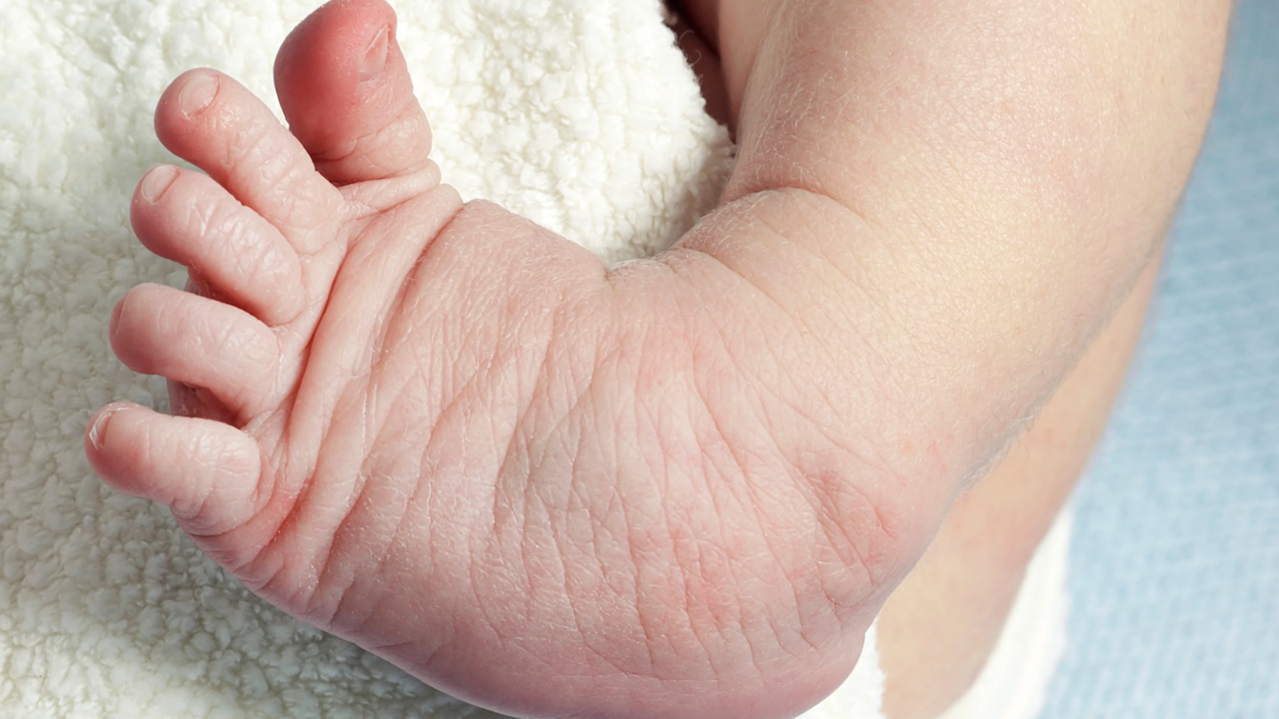 Dị tật cơ xương khớp: Nguyên nhân và hướng điều trị hiệu quả
