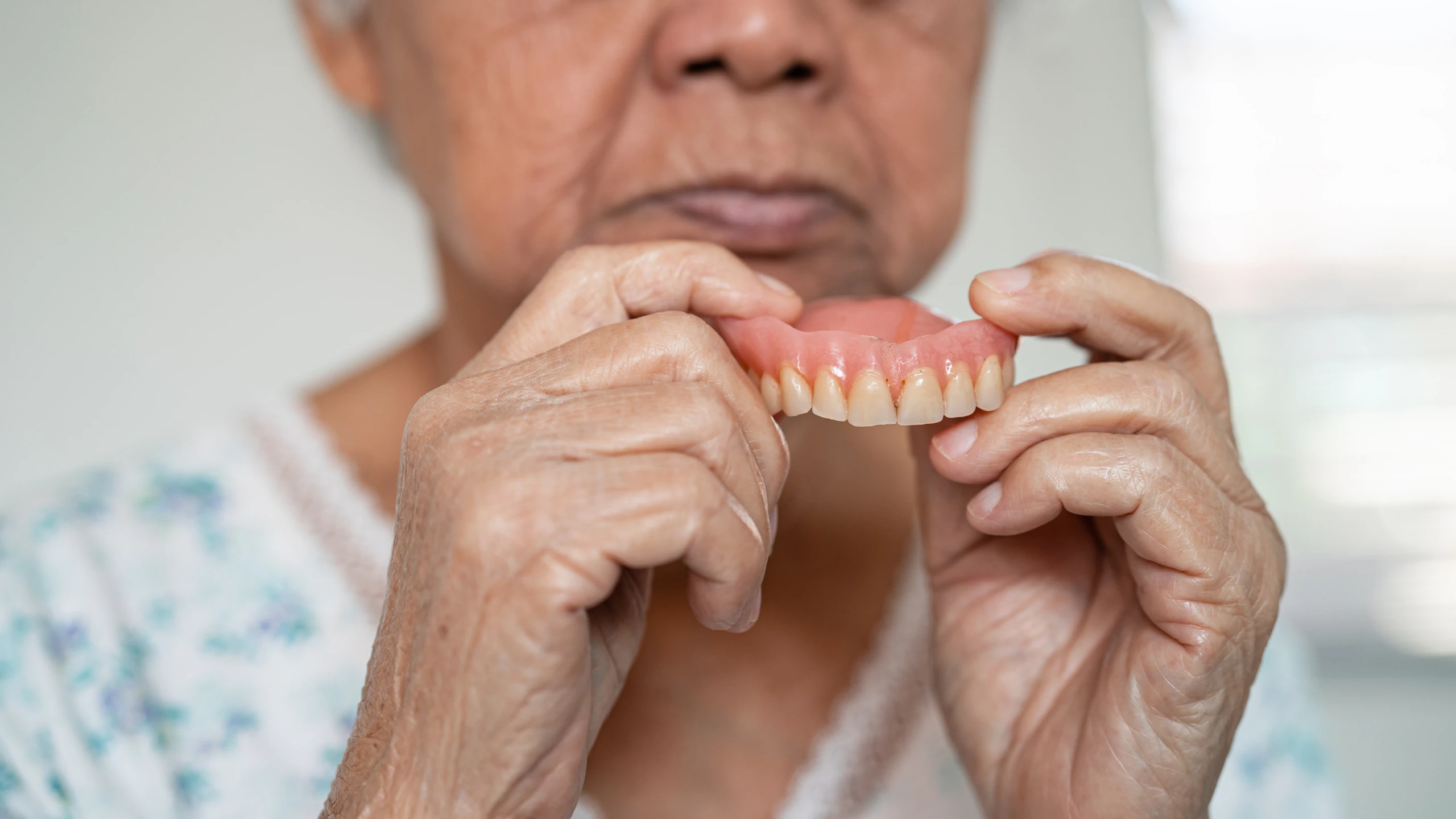 Hàm răng giả nhiều năm chưa hỏng: Vì sao vẫn cần kiểm tra?