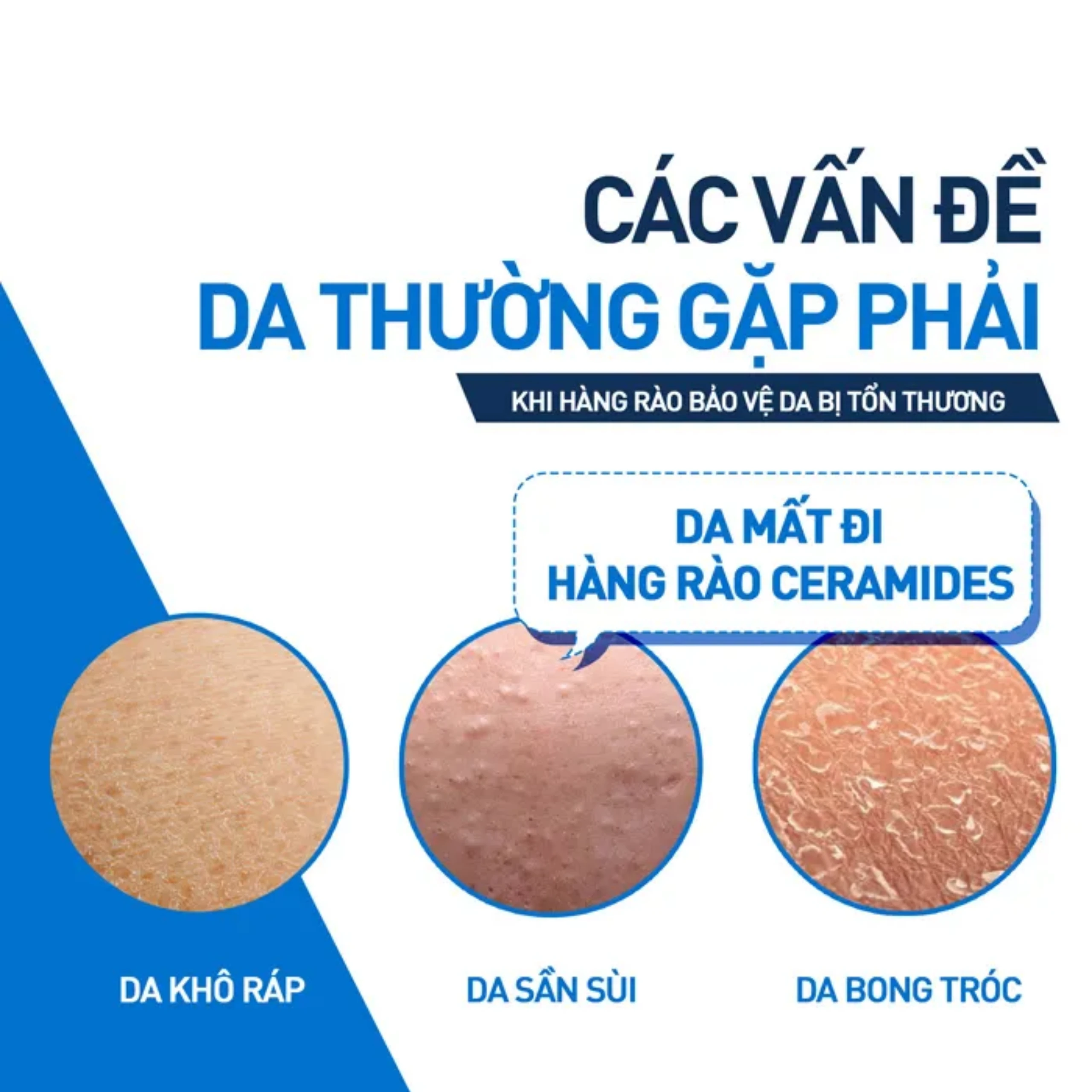 Kem bôi CeraVe Moisturising Cream dưỡng ẩm, phục hồi cho da khô (454g)