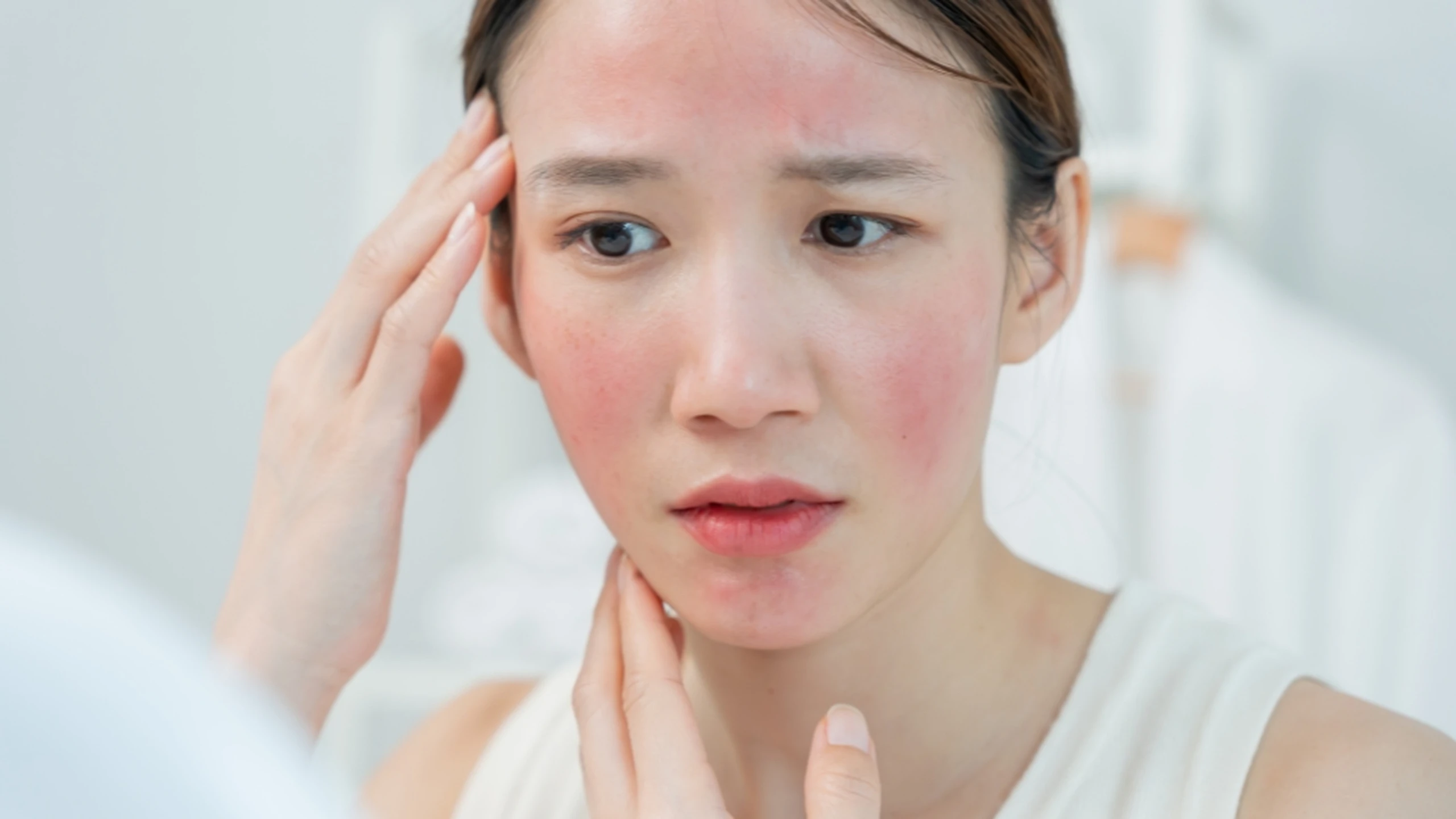 Kem dưỡng ẩm cho viêm da cơ địa: 8 loại dịu nhẹ nên dùng