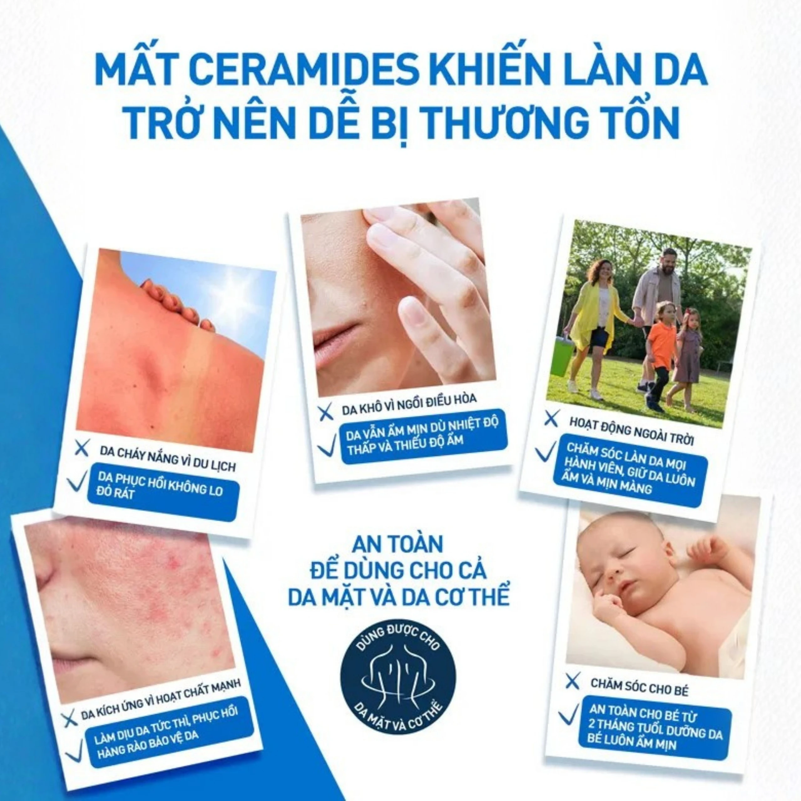 Kem dưỡng ẩm cho da khô Cerave Moisturising Cream 340g