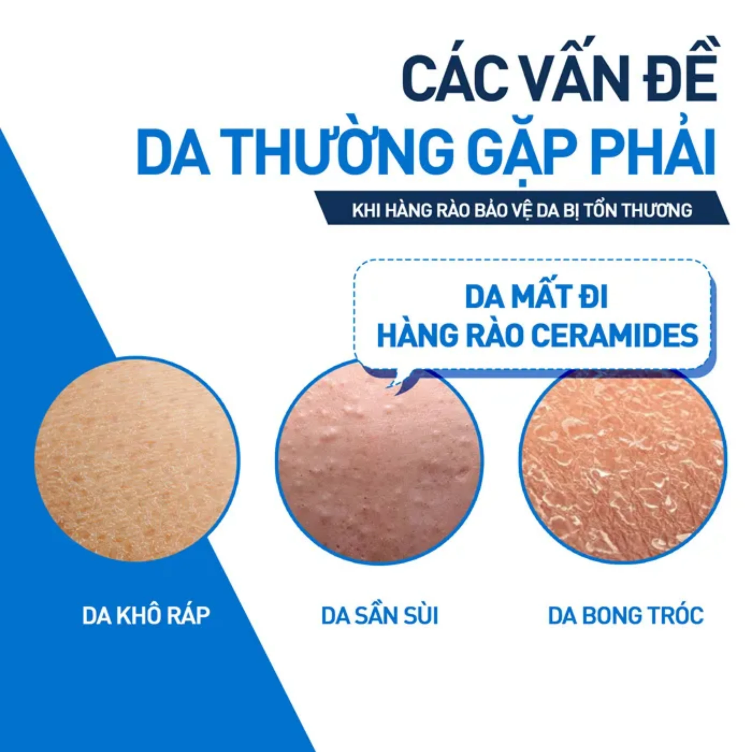 Kem dưỡng ẩm cho da khô CeraVe Moisturising Cream (50ml)