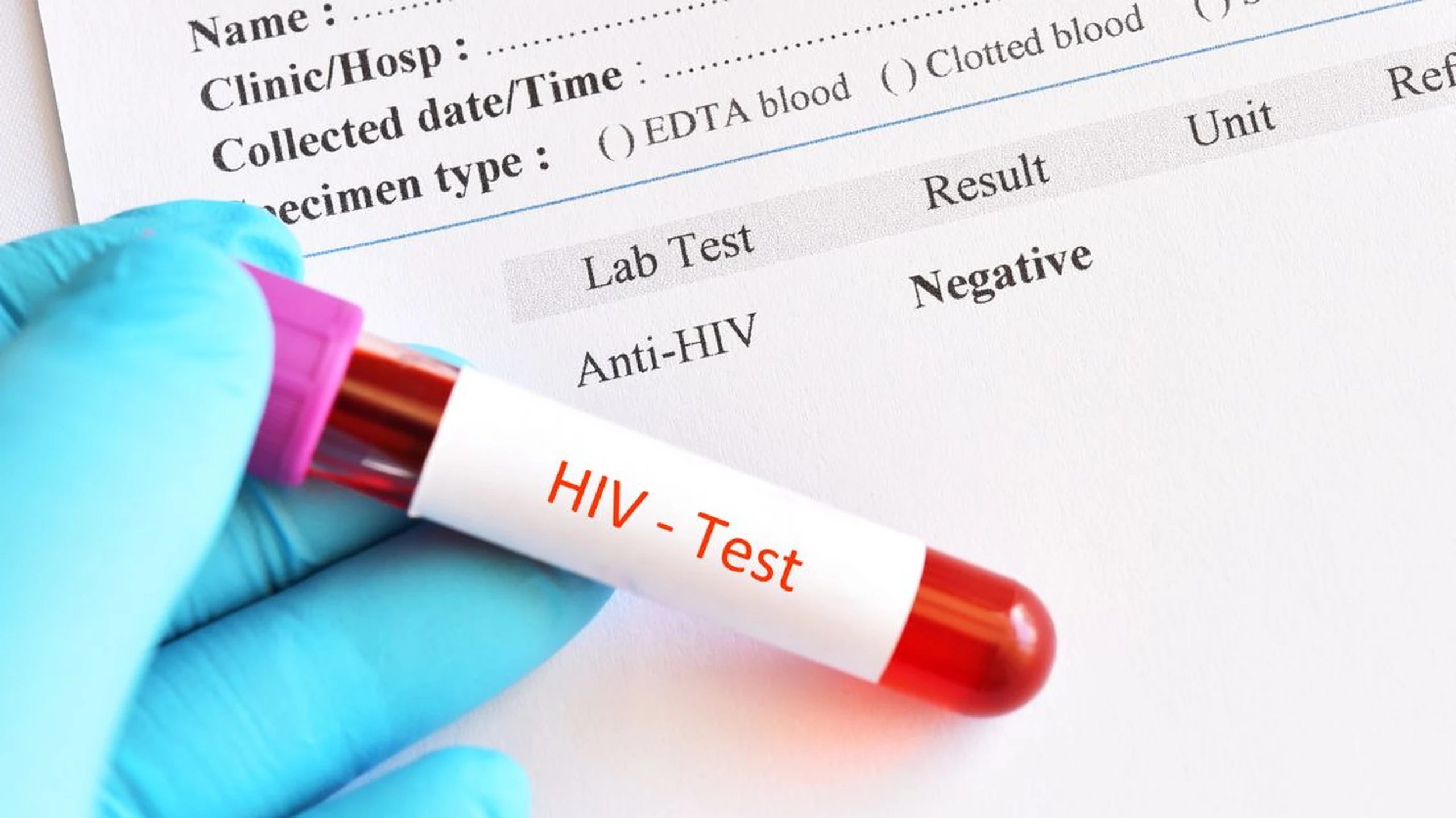 Kết quả xét nghiệm HIV âm tính: Đã chắc chắn không nhiễm HIV chưa?