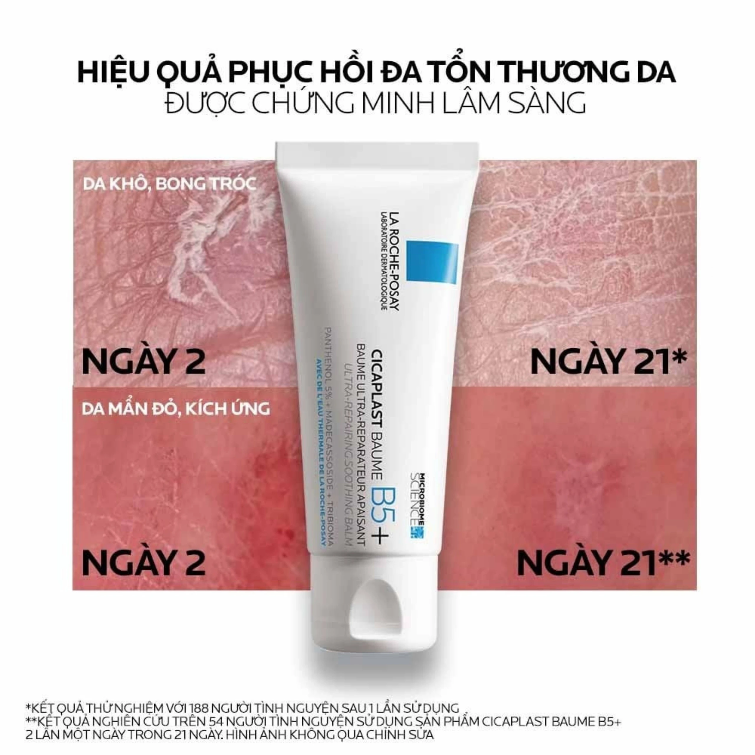 Kem bôi phục hồi và dịu da La Roche-posay Cicaplast Baume B5+ 40ml