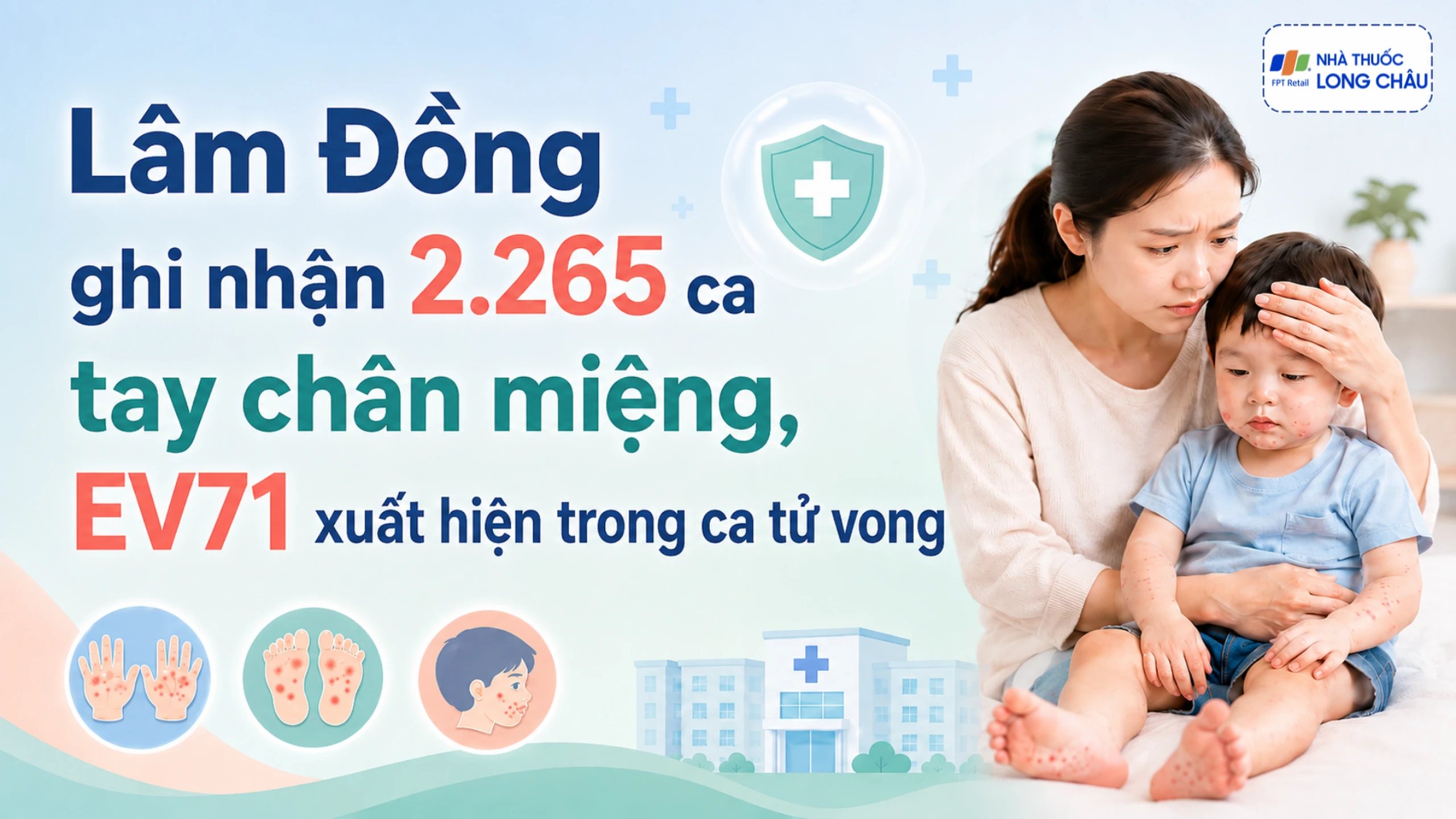 Lâm Đồng ghi nhận 2.265 ca tay chân miệng, EV71 xuất hiện trong ca tử vong