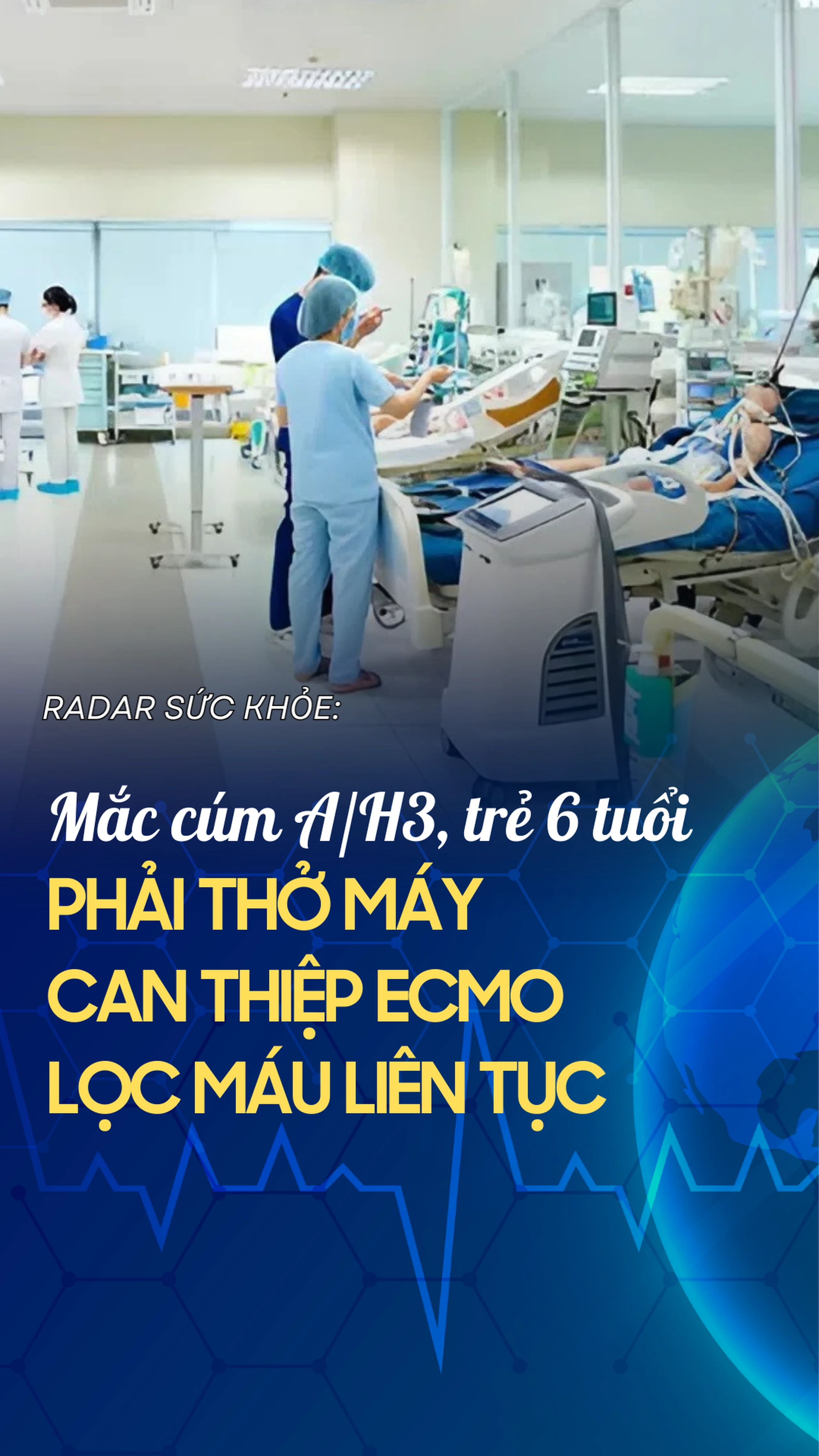 Mắc cúm A/H3, trẻ 6 tuổi phải thở máy, can thiệp ECMO, lọc máu liên tục