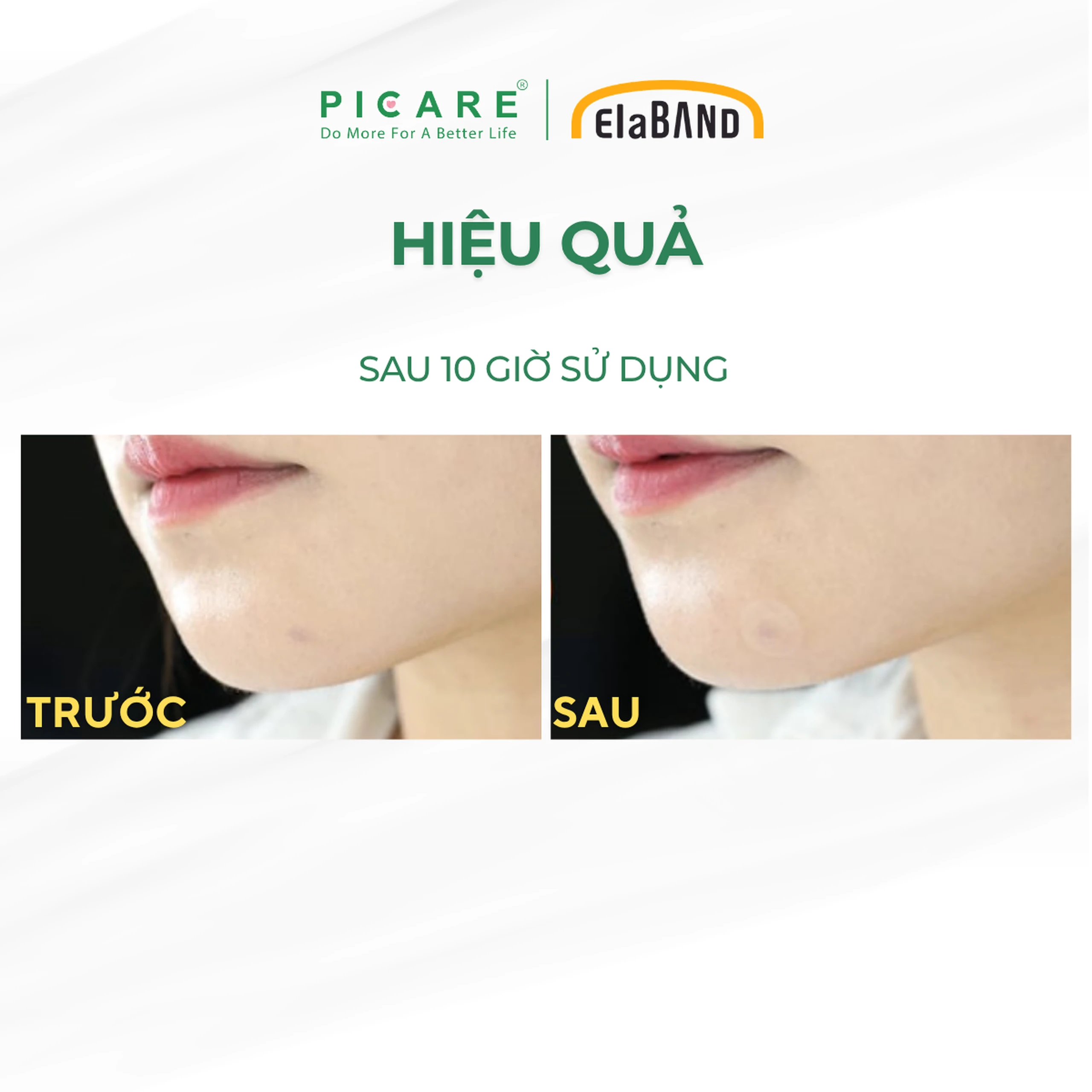 Miếng dán mụn Elaband Hydrodot Teatree (23 miếng) hút dịch mụn, giảm sưng viêm 6