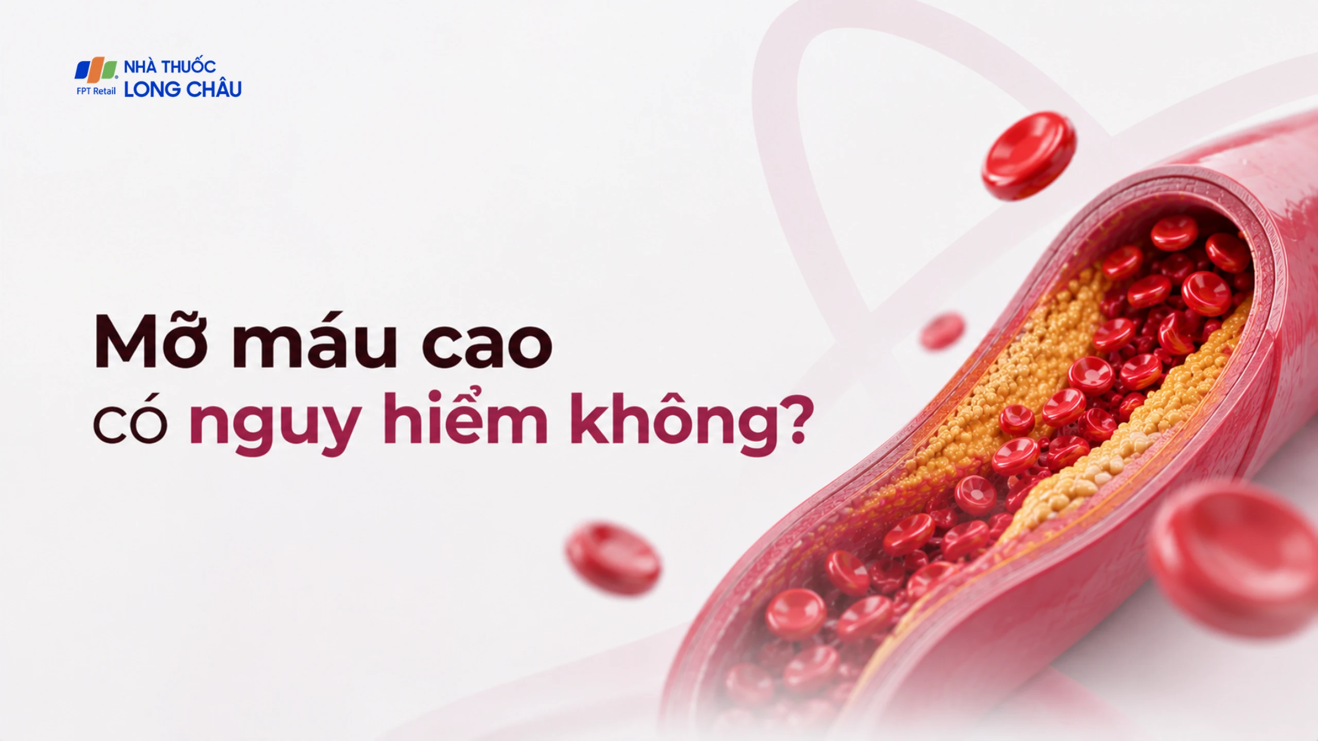 Mỡ máu cao nguy hiểm như thế nào? Điều nhiều người chỉ phát hiện sau nhồi máu cơ tim hoặc đột quỵ