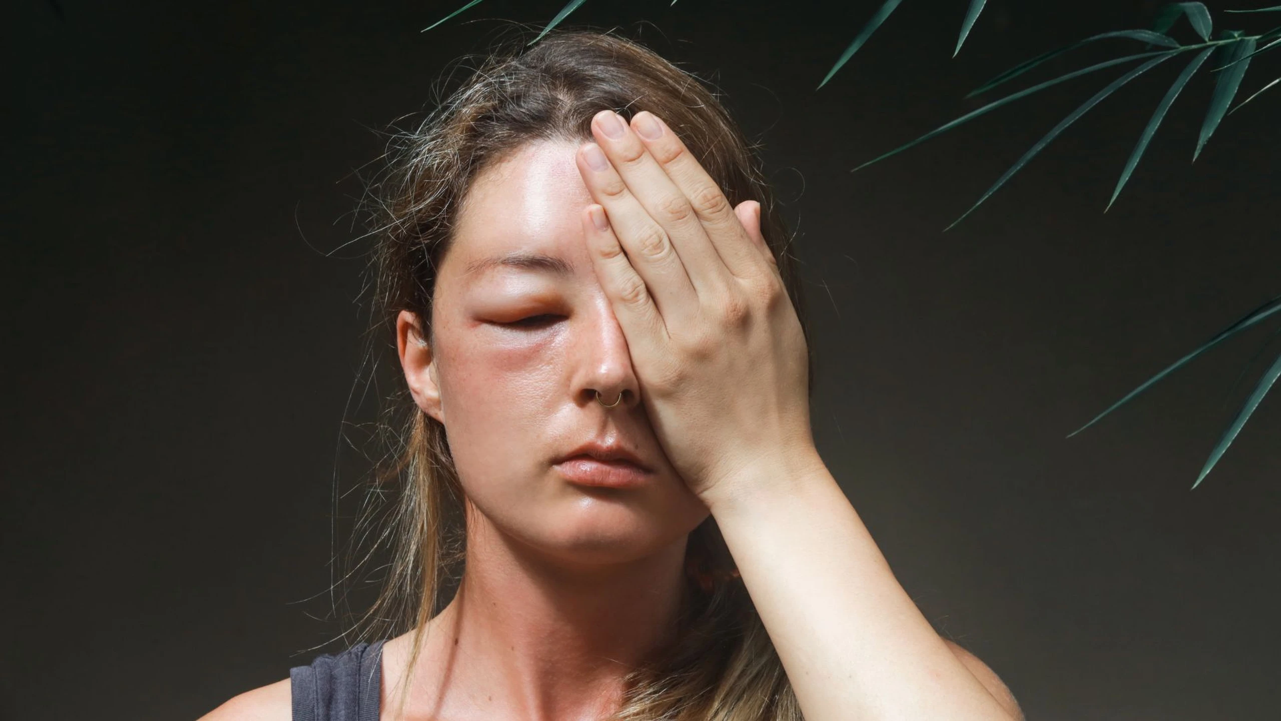 Một số cách làm mắt hết sưng an toàn, hiệu quả? Một số lưu ý khi giảm sưng mắt tại nhà?