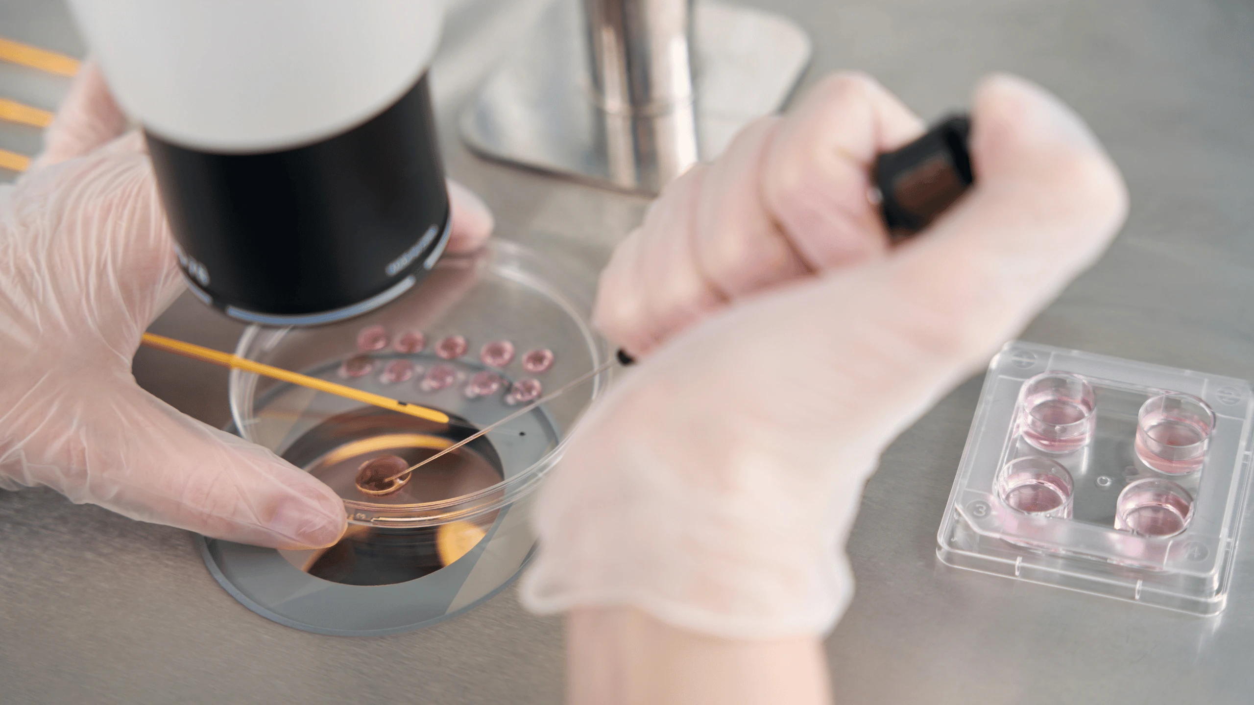 Làm IVF nên chuyển phôi tươi hay phôi trữ đông sẽ tốt hơn?