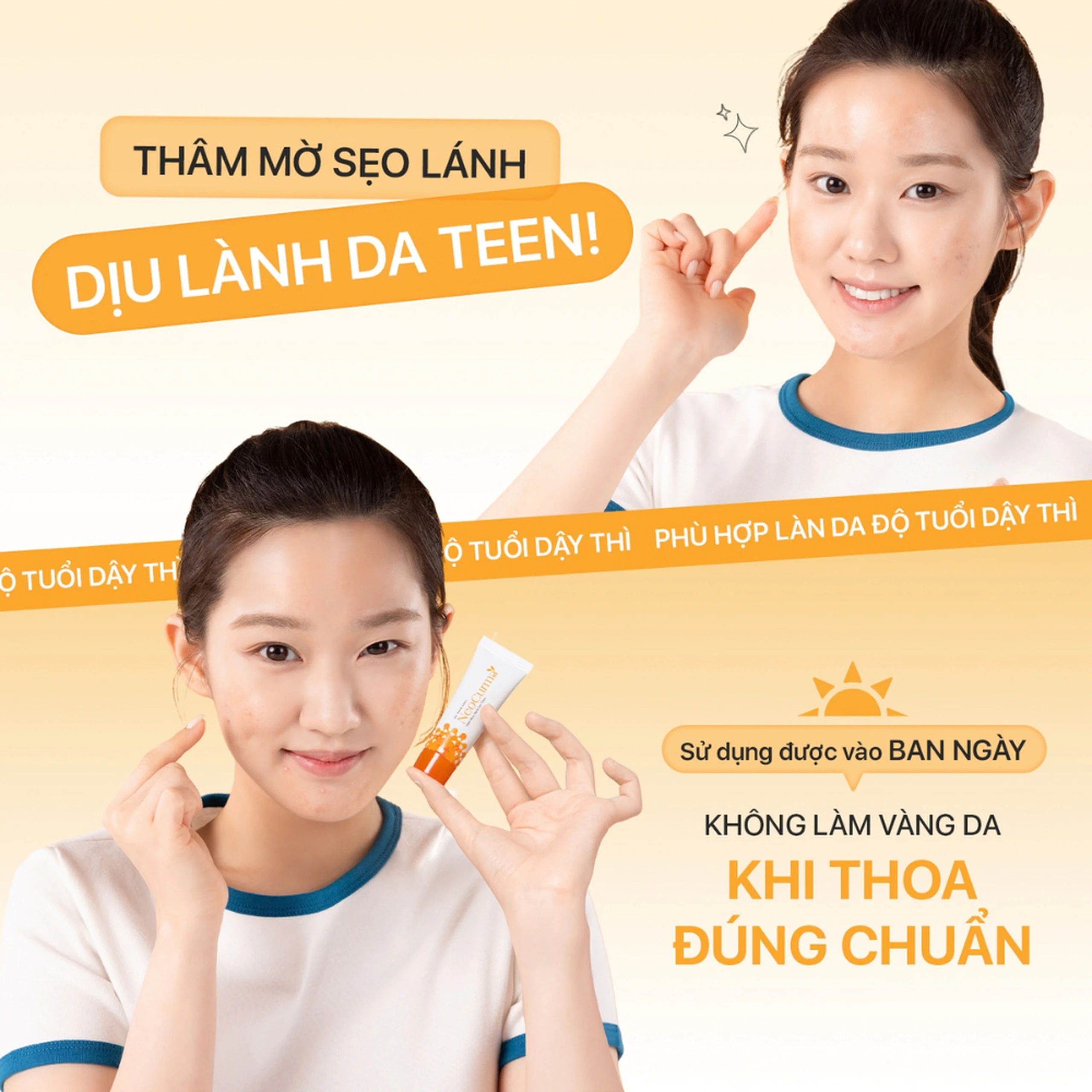Gel Nghệ NeoCurma giảm mụn, ngừa sẹo, mờ vết thâm (20g) 1