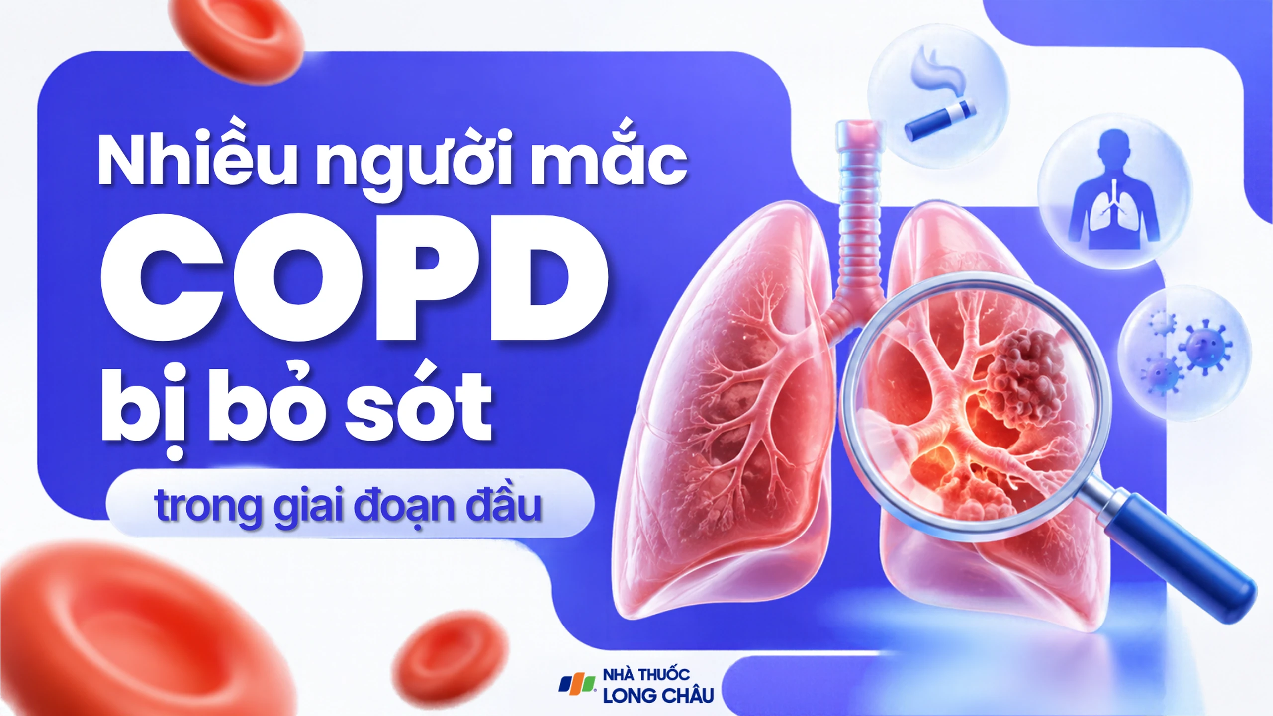 Nhiều người mắc COPD bị bỏ sót, ai cần tầm soát sớm?