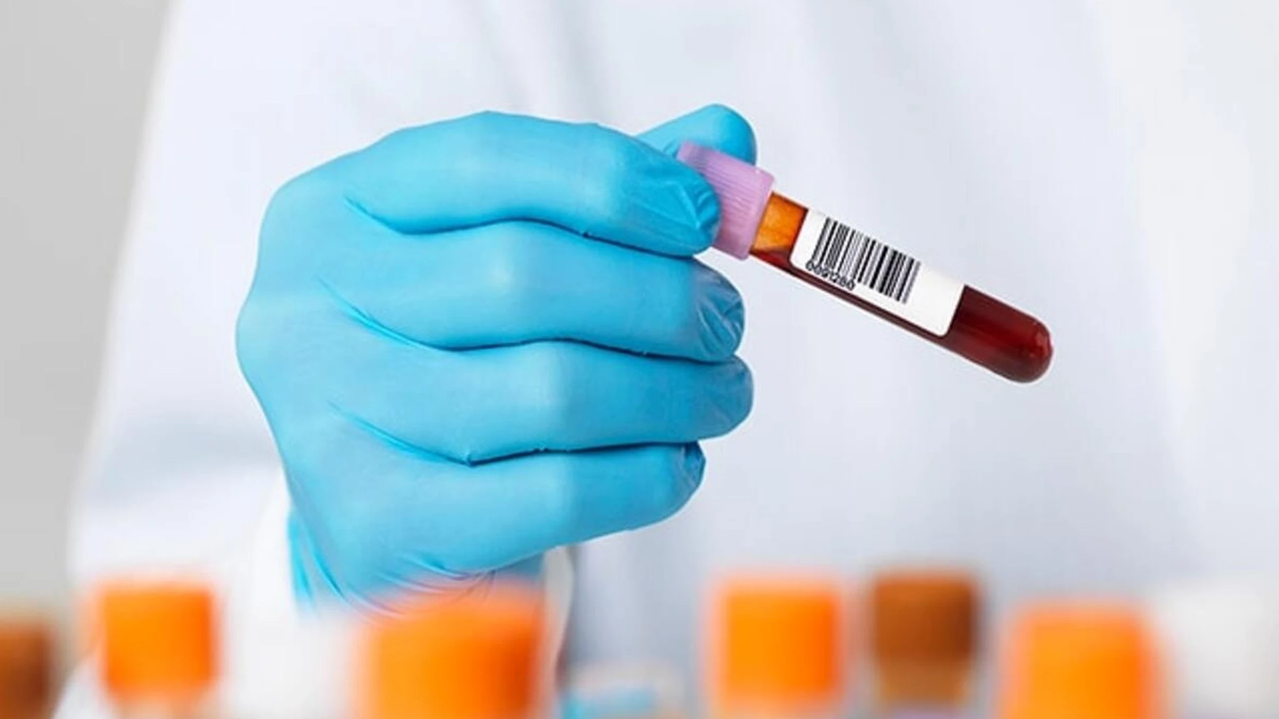 Những điều cần biết về xét nghiệm widal: Xét nghiệm tìm kháng thể kháng thương hàn