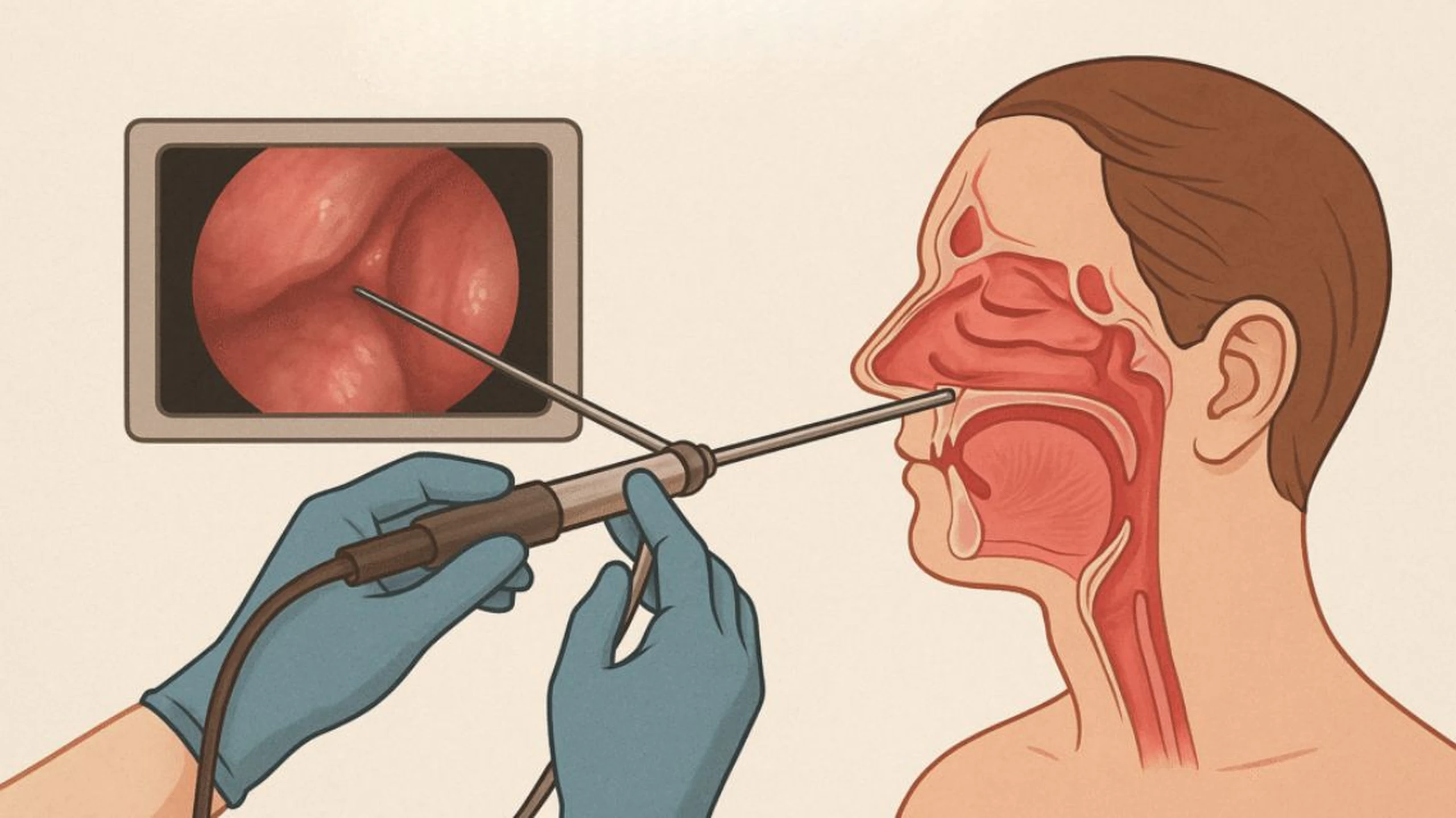 Nội soi viêm xoang: Khi nào cần thực hiện và có đau không?