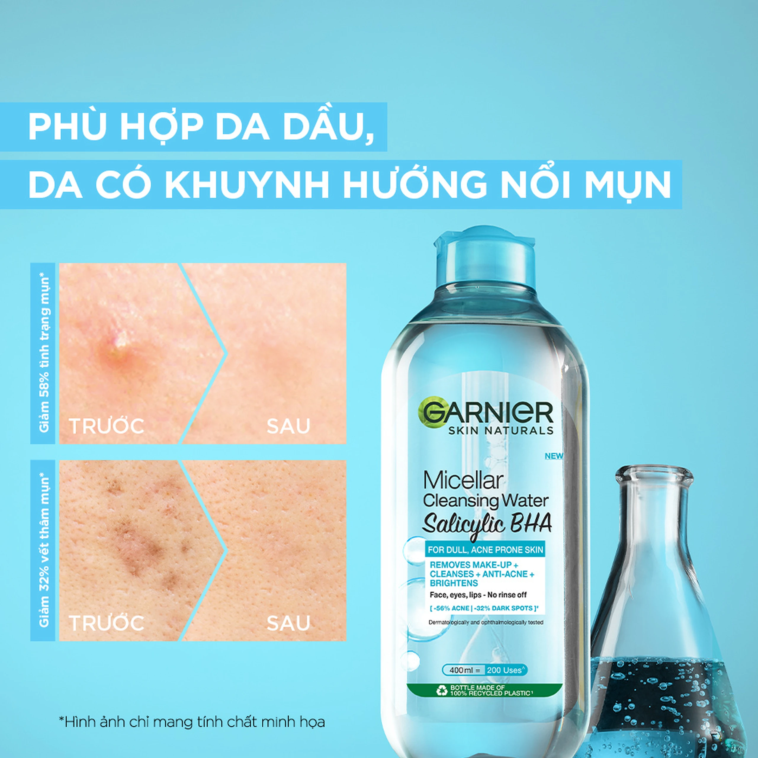 Nước tẩy trang cho da dầu, mụn Garnier Skin Naturals Micellar 400ml 6