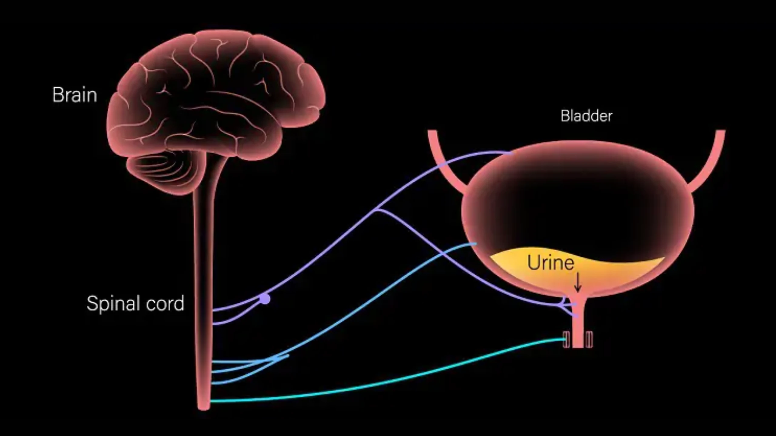 Rối loạn thần kinh bàng quang: Nguyên nhân, triệu chứng 1