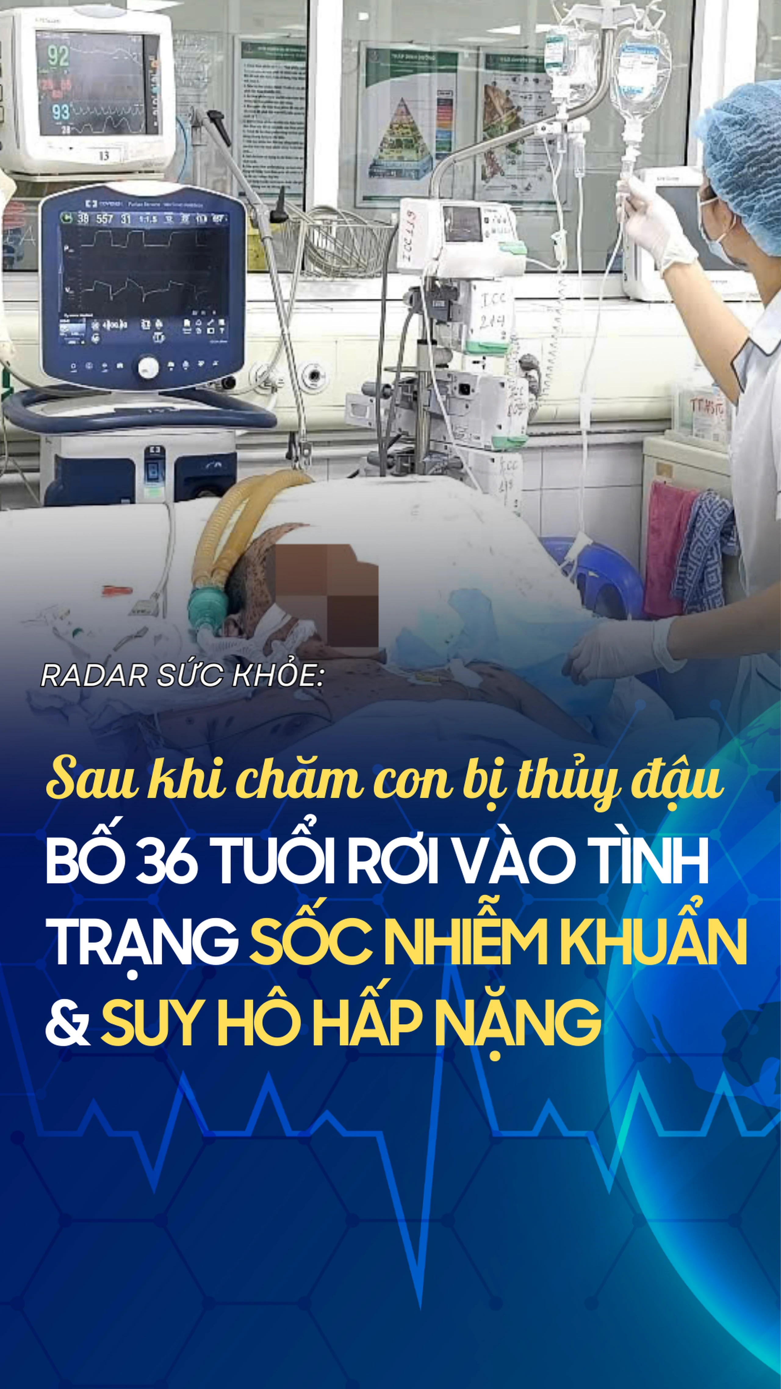 Sau khi chăm con bị thủy đậu, bố 36 tuổi rơi vào tình trạng sốc nhiễm khuẩn, suy hô hấp nặng