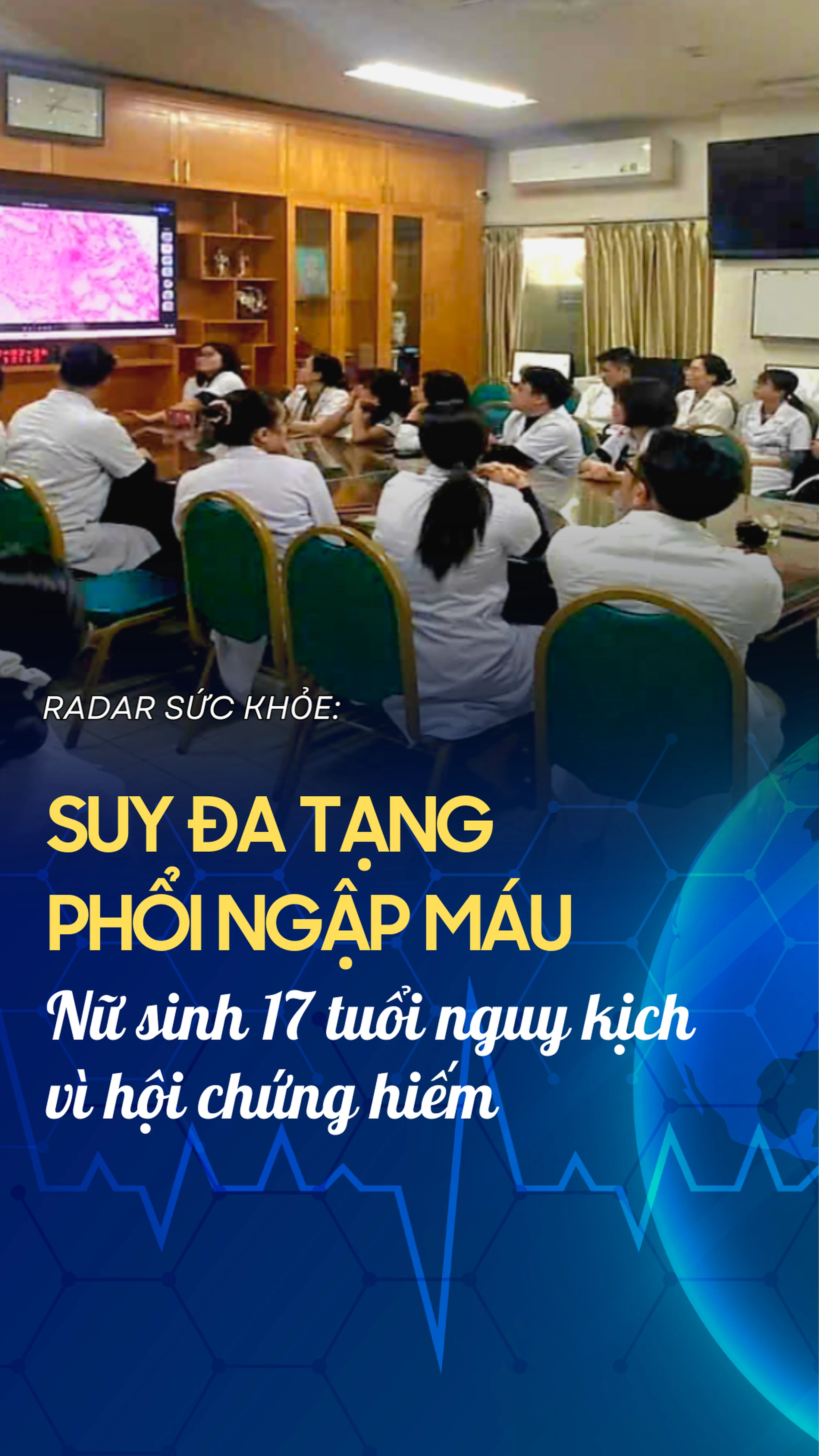 "Suy đa tạng, phổi ngập máu: Nữ sinh 17 tuổi nguy kịch vì hội chứng hiếm "