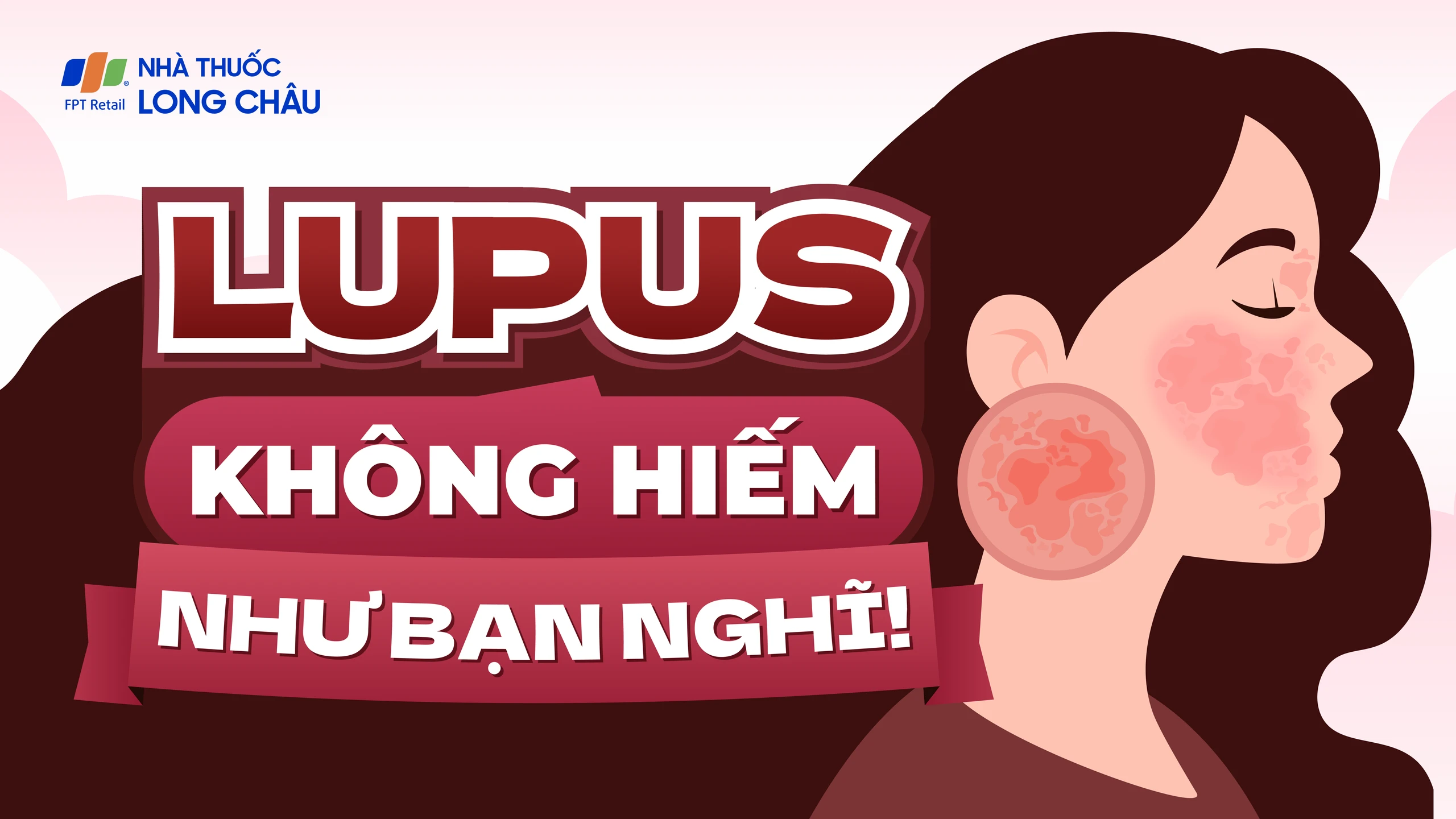 [Infographic] Lupus không hiếm như bạn nghĩ!