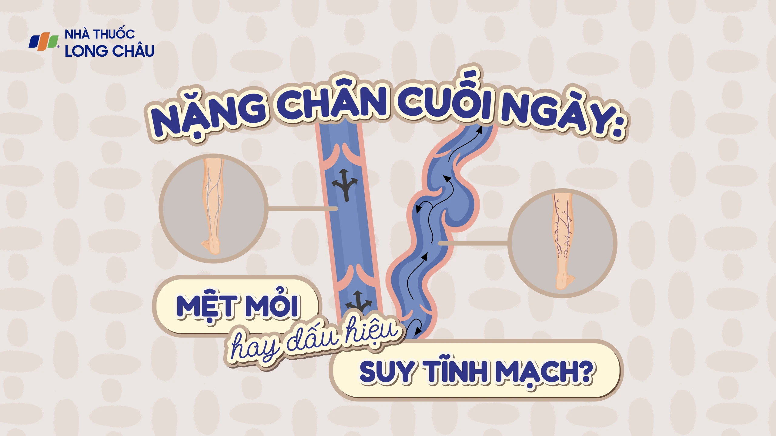 [Infographic] Nặng chân cuối ngày: Mệt mỏi hay dấu hiệu suy tĩnh mạch?