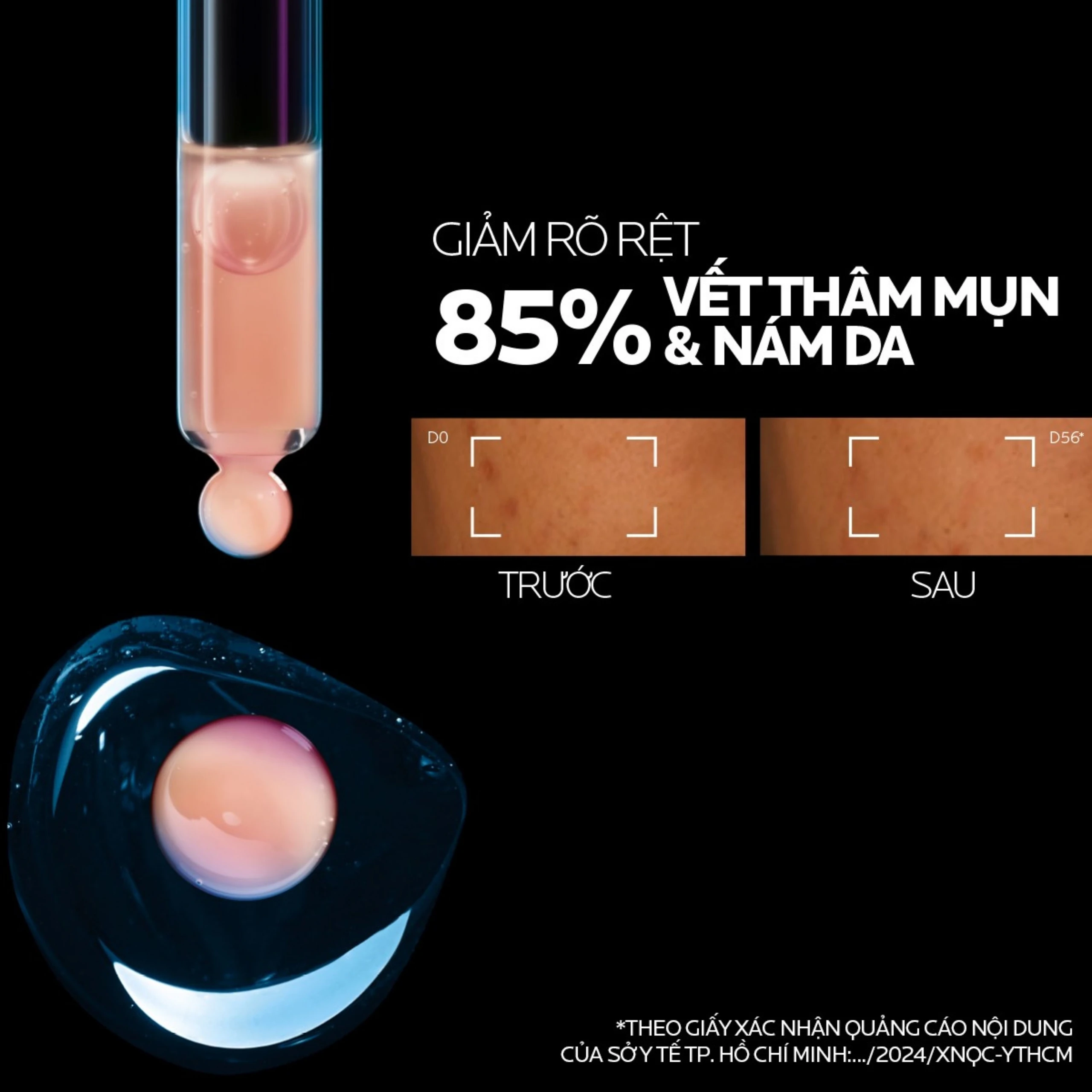 Tinh chất La Roche-Posay Mela B3 Serum dưỡng da mềm mịn, mờ thâm nám, da sáng và đều màu