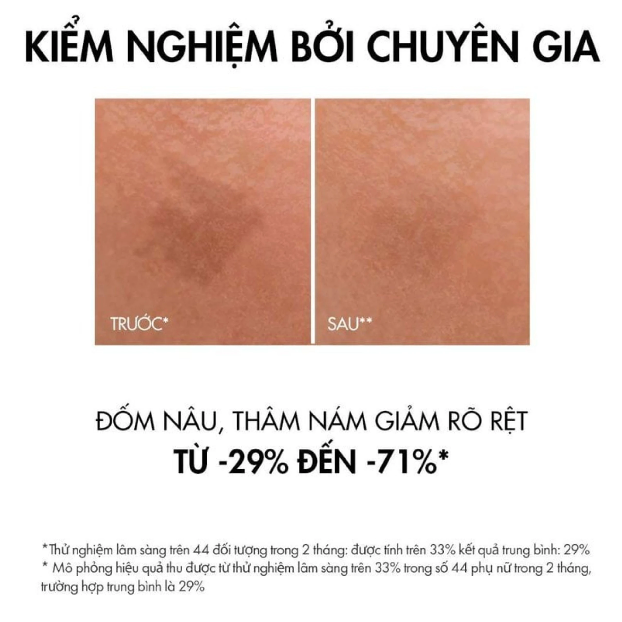 Tinh chất ngăn ngừa thâm nám, đốm nâu Liftactiv Specialist B3 Serum 30ml Vichy