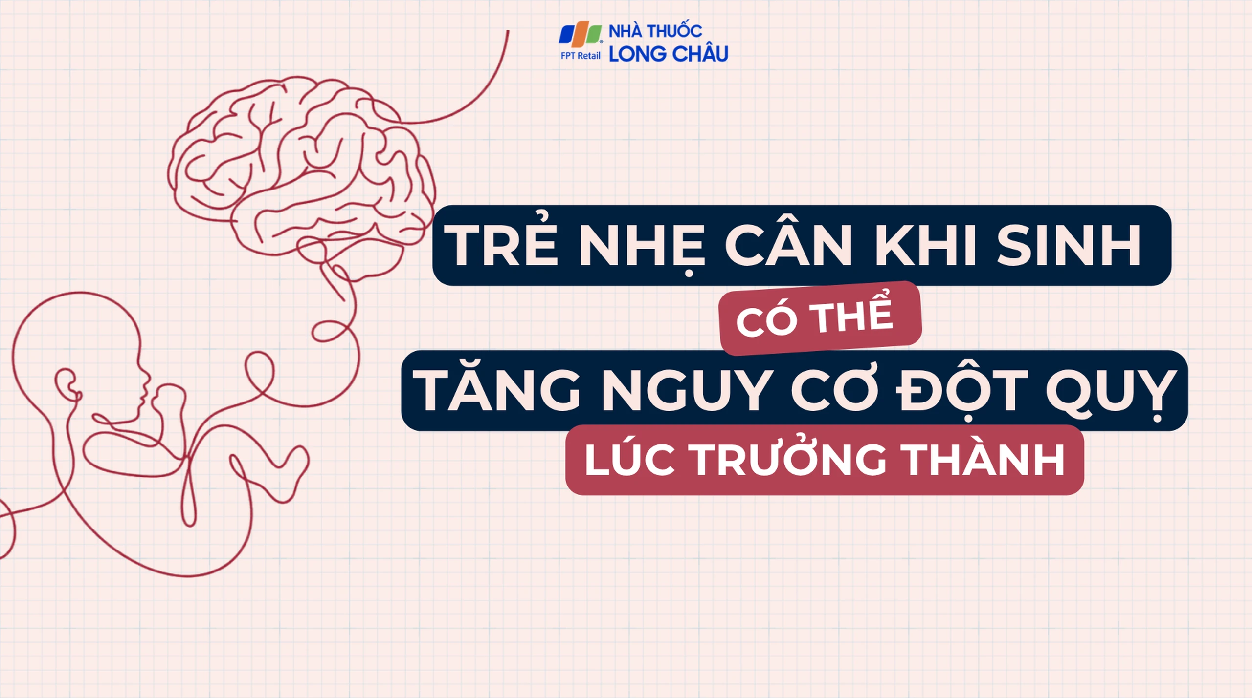 Trẻ nhẹ cân khi sinh có thể tăng nguy cơ đột quỵ khi trưởng thành